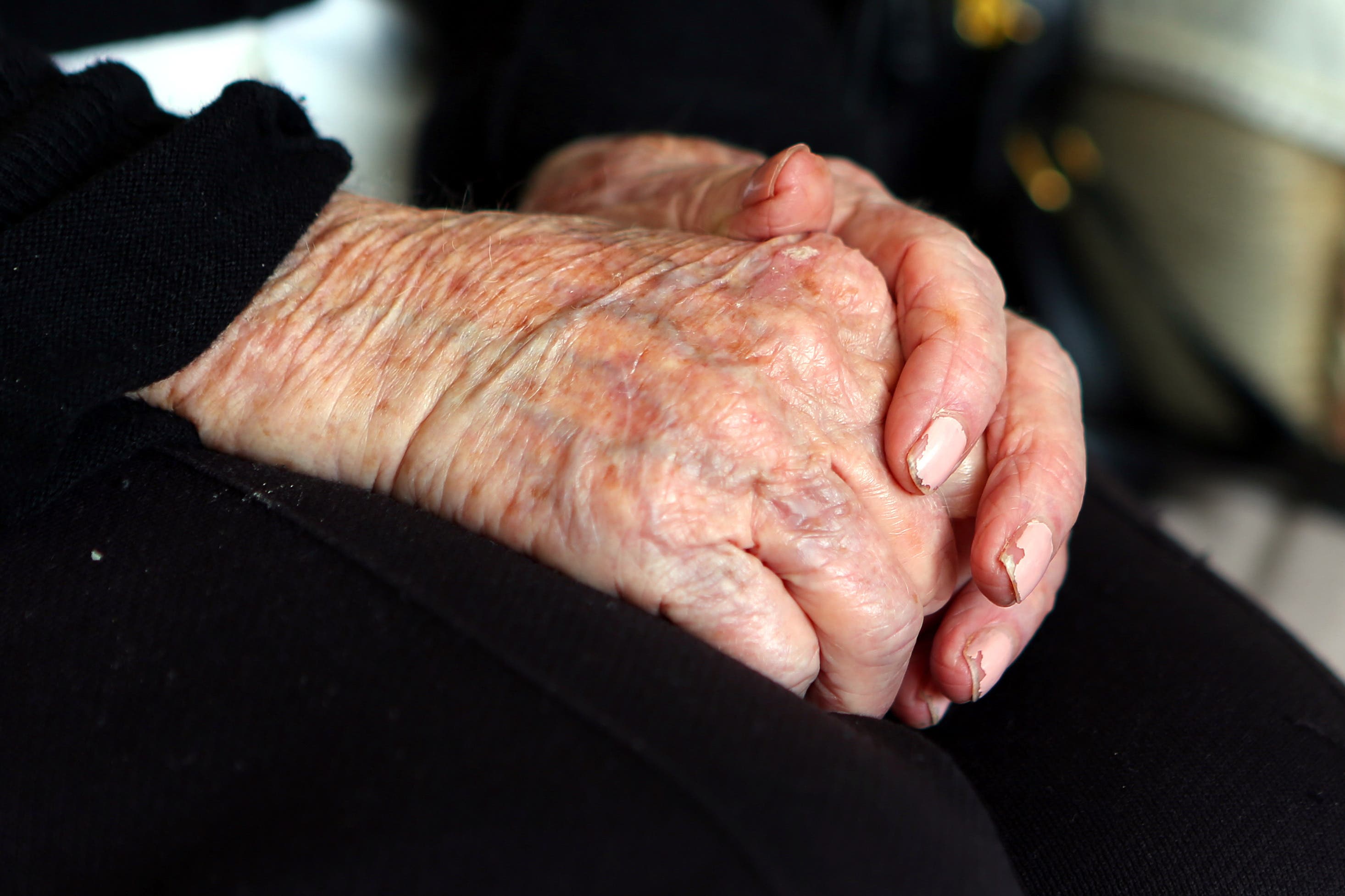 More than 850,000 people are living with dementia in the UK