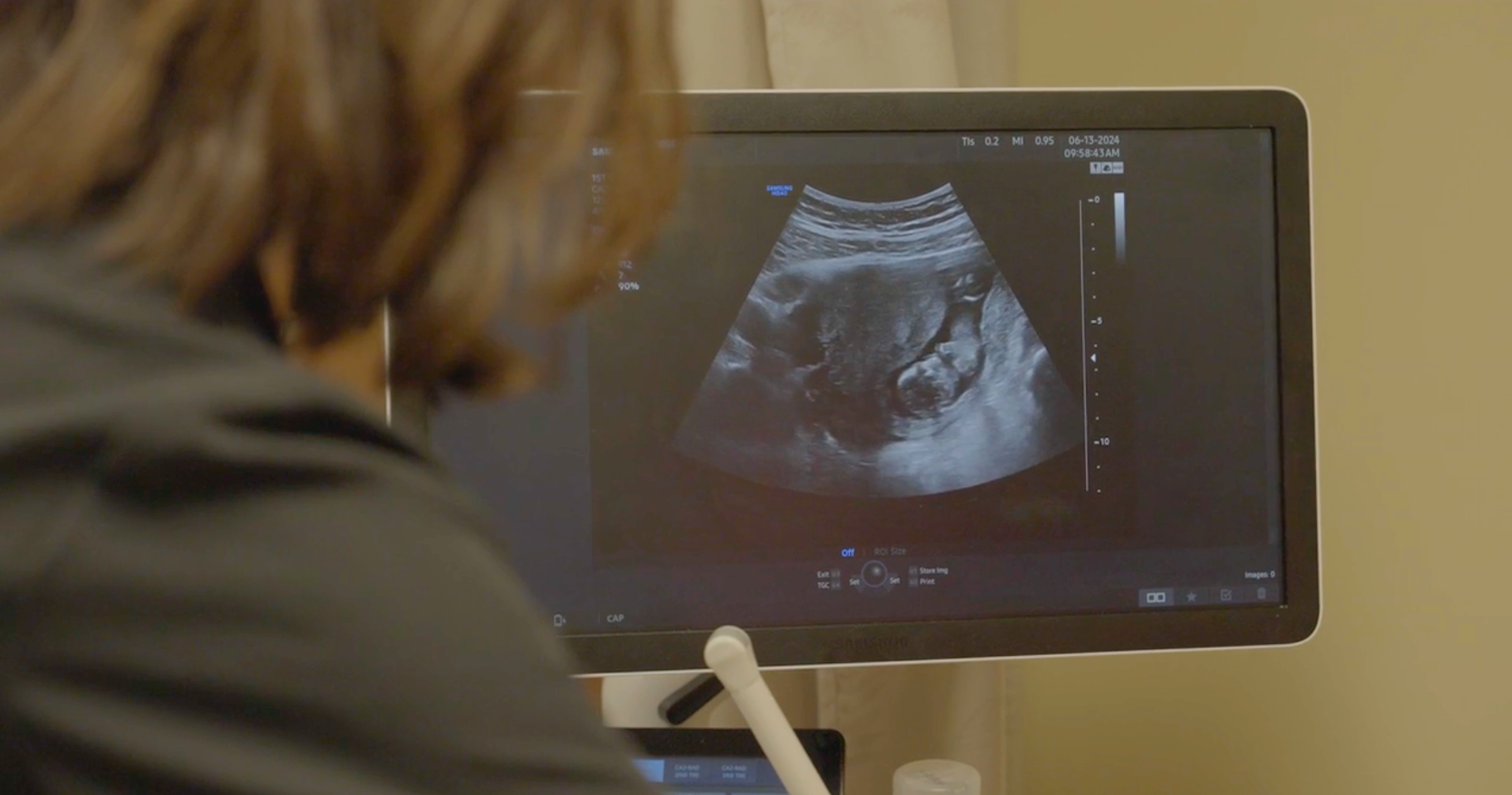 A Tennessee doctor conducts an ultrasound on a pregnant patient