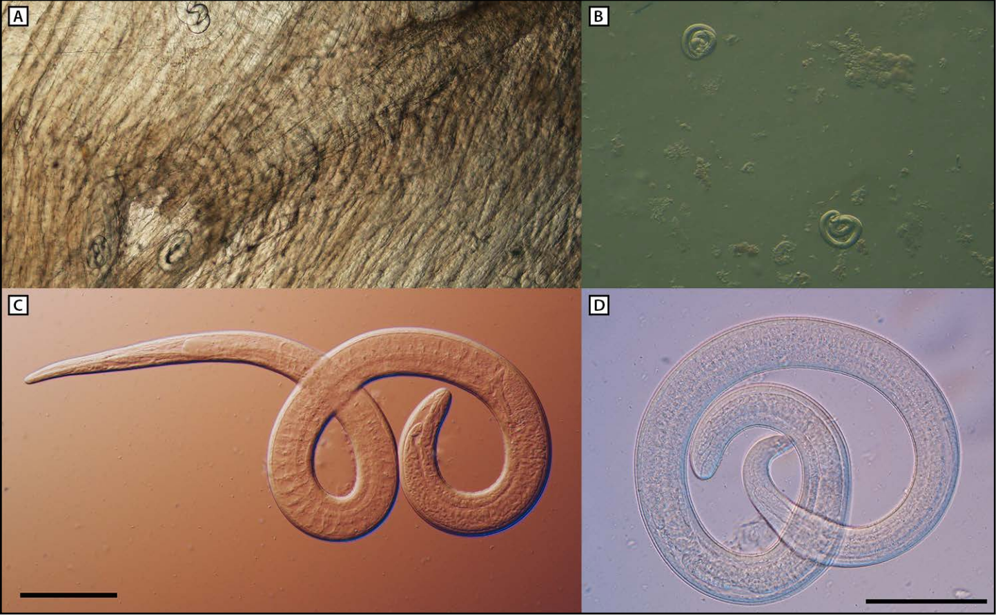 Pictured is the microscopic examination of encapsulated larvae in black bear meat attributed to an outbreak of Trichinella in 2022