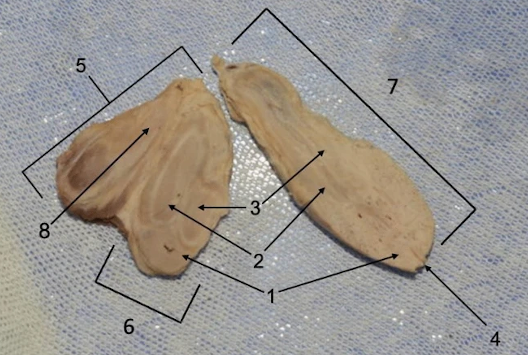 Primary, secondary, and tertiary penises labelled 7, 6, and 5 respectively