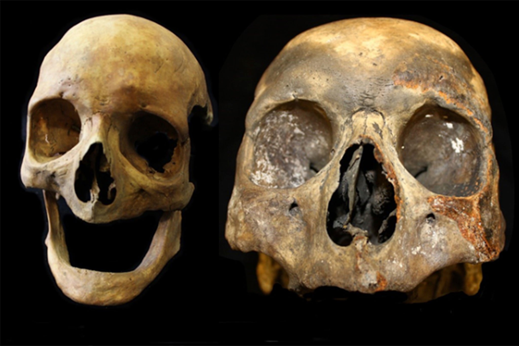 The discovery of changes to bone structure amongst the remains of tobacco users allows archaeologists to categorise remains without teeth for the first time