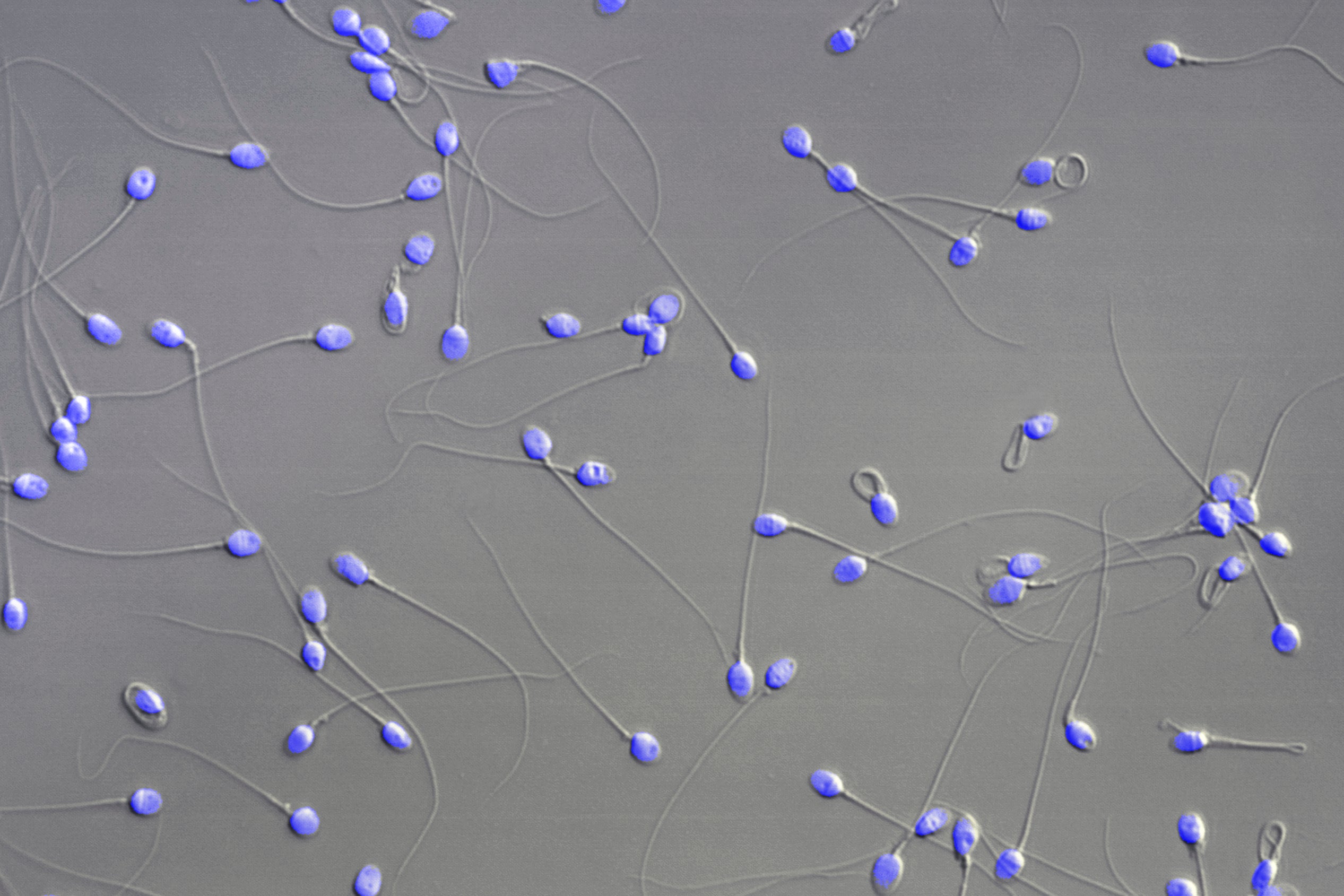 Beginning of Life-Study