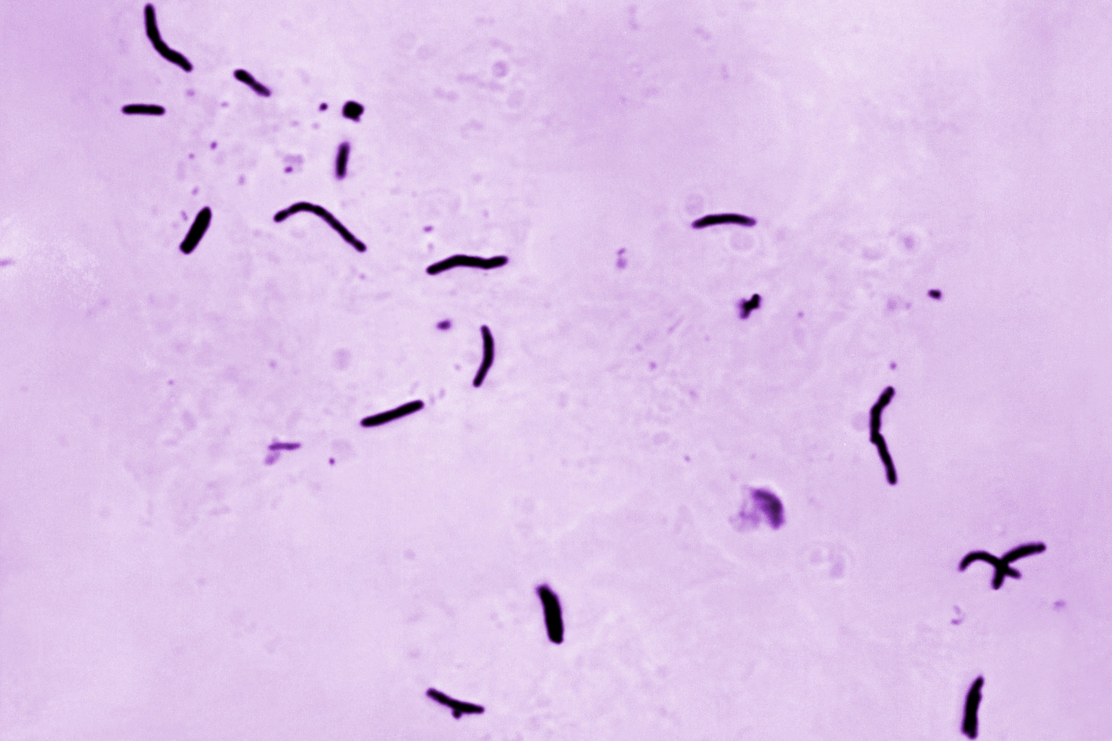 This 1966 microscope photo provided by the U.S. Centers for Disease Control and Prevention shows Mycobacterium tuberculosis bacilli