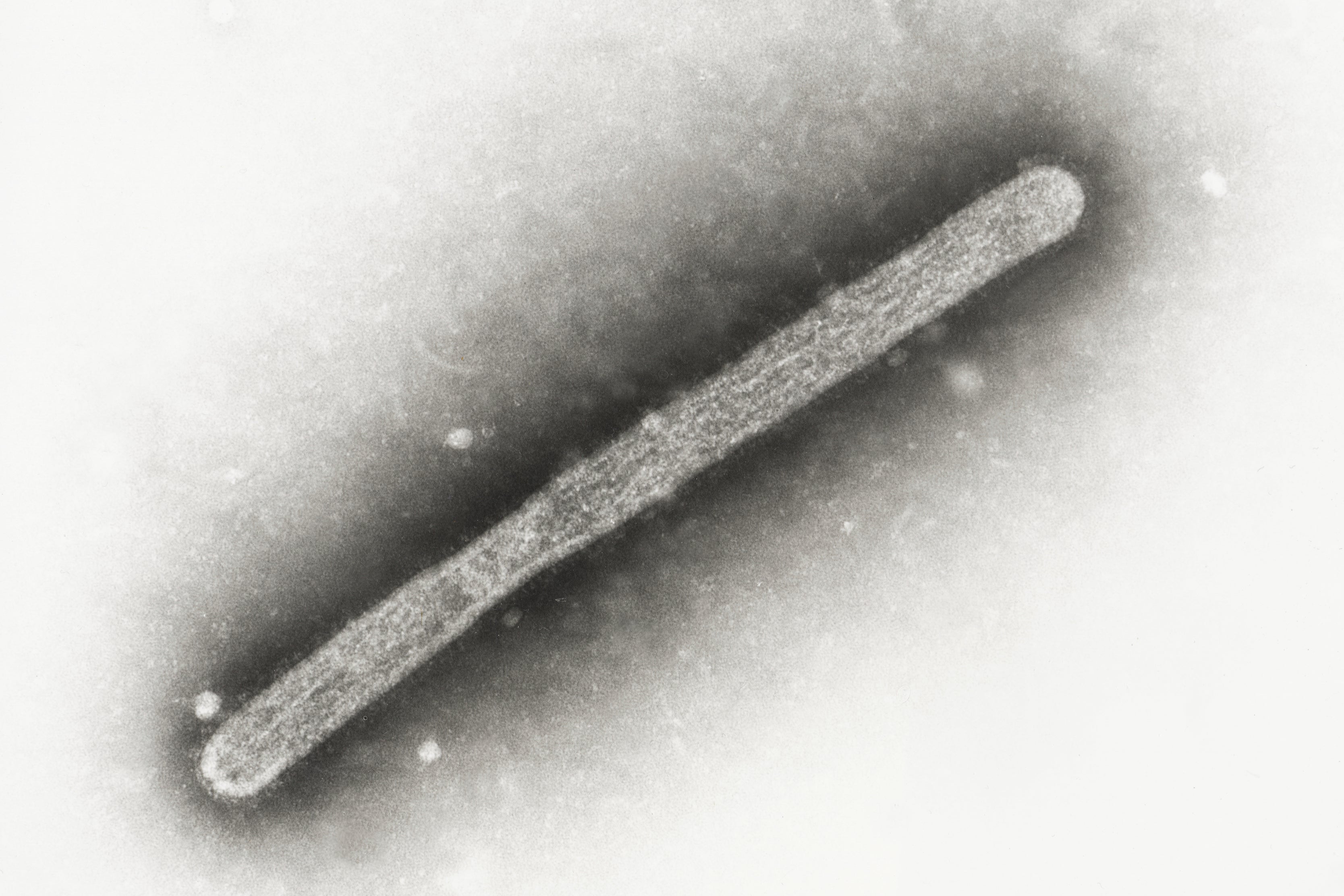 An electron microscope image shows a particle of the H5N1 bird flu. The virus is spreading across livestock and poultry in 14 states