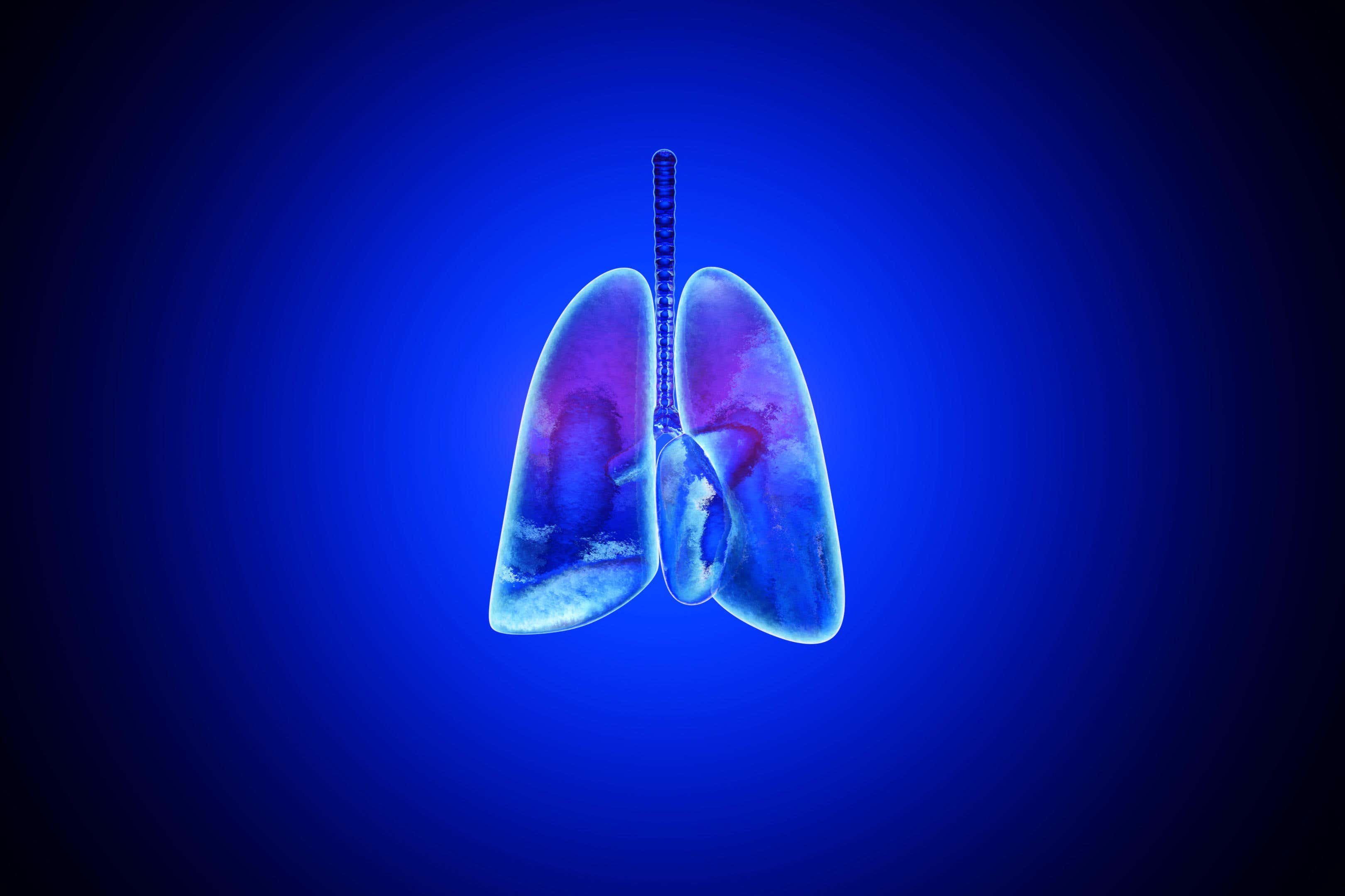 More than 5,000 people in England have been diagnosed with lung cancer earlier thanks to an innovative NHS initiative (Alamy/PA)