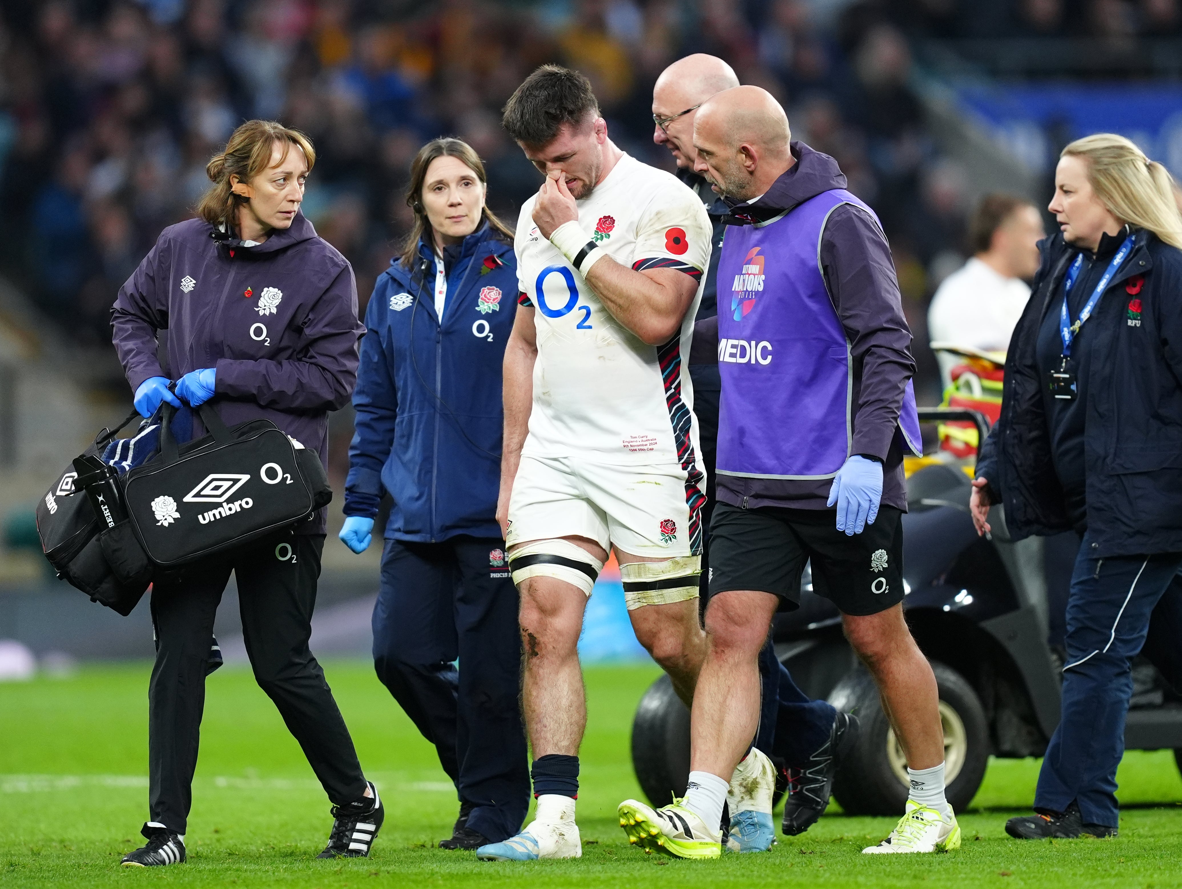 Tom Curry was knocked out against Australia on Saturday (David Davies/PA)