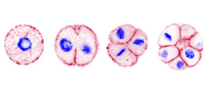 Multicellular development of Chromosphaera perkinsii