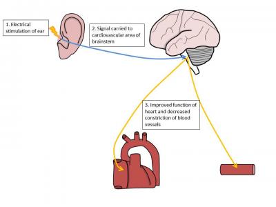 Previous study has found tickling ears to be good for heart by stimulating vagus nerve