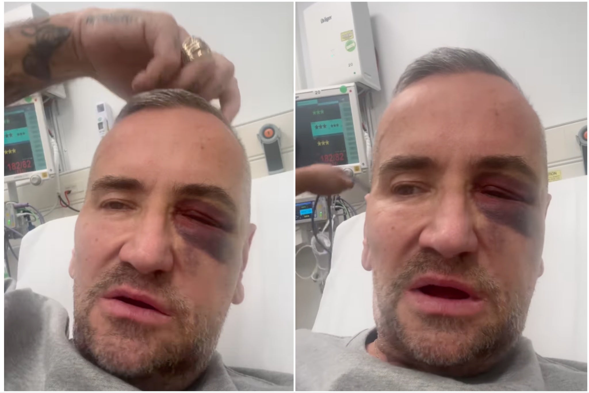 DJ FatTony shared pictures of his injuries