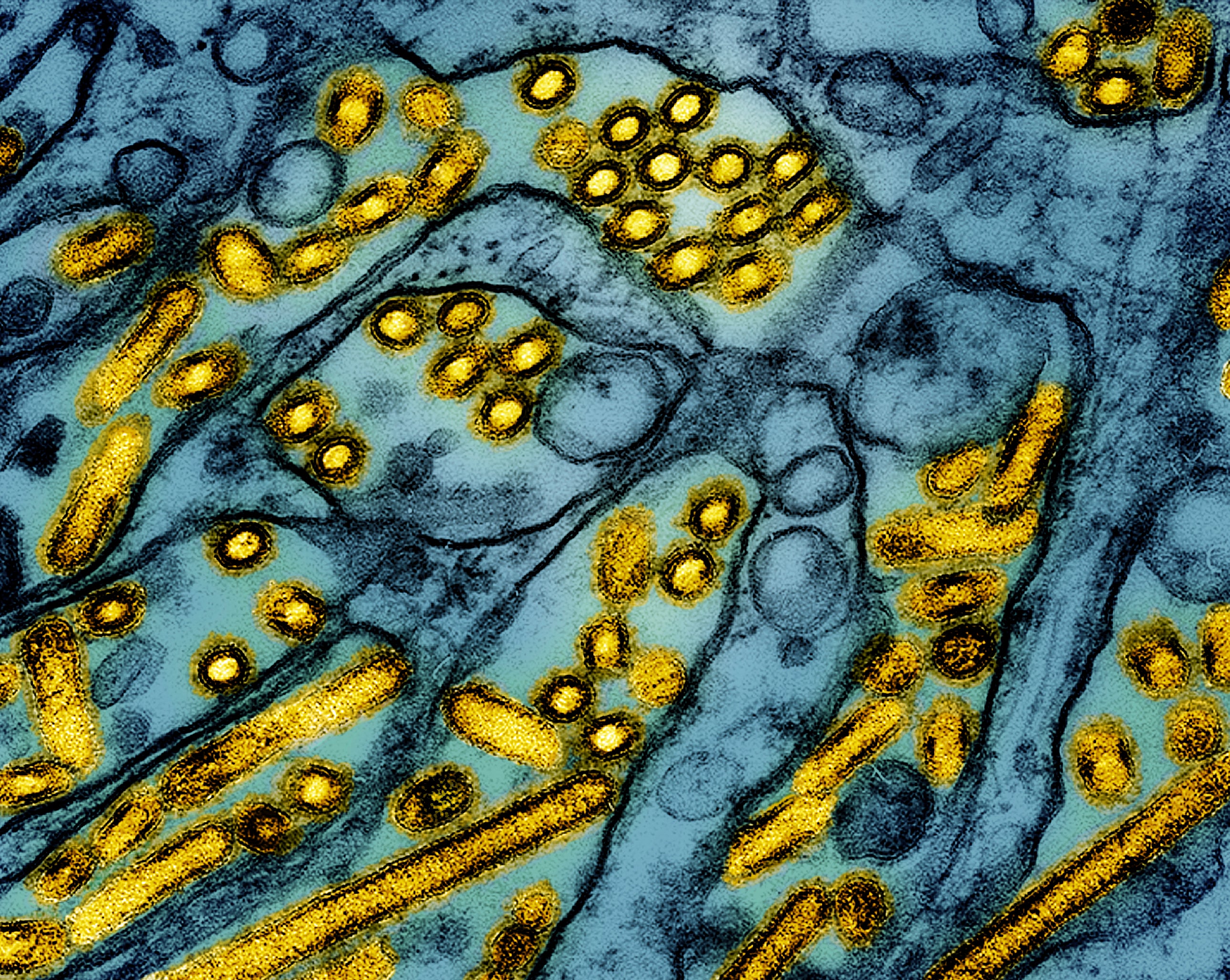 A microscope image shows particles of the H5N1 virus. Louisiana has reported the nation’s first severe illness caused by bird flu