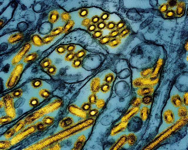 <p>A microscope image shows particles of the H5N1 virus. Louisiana has reported the nation’s first severe illness caused by bird flu  </p>