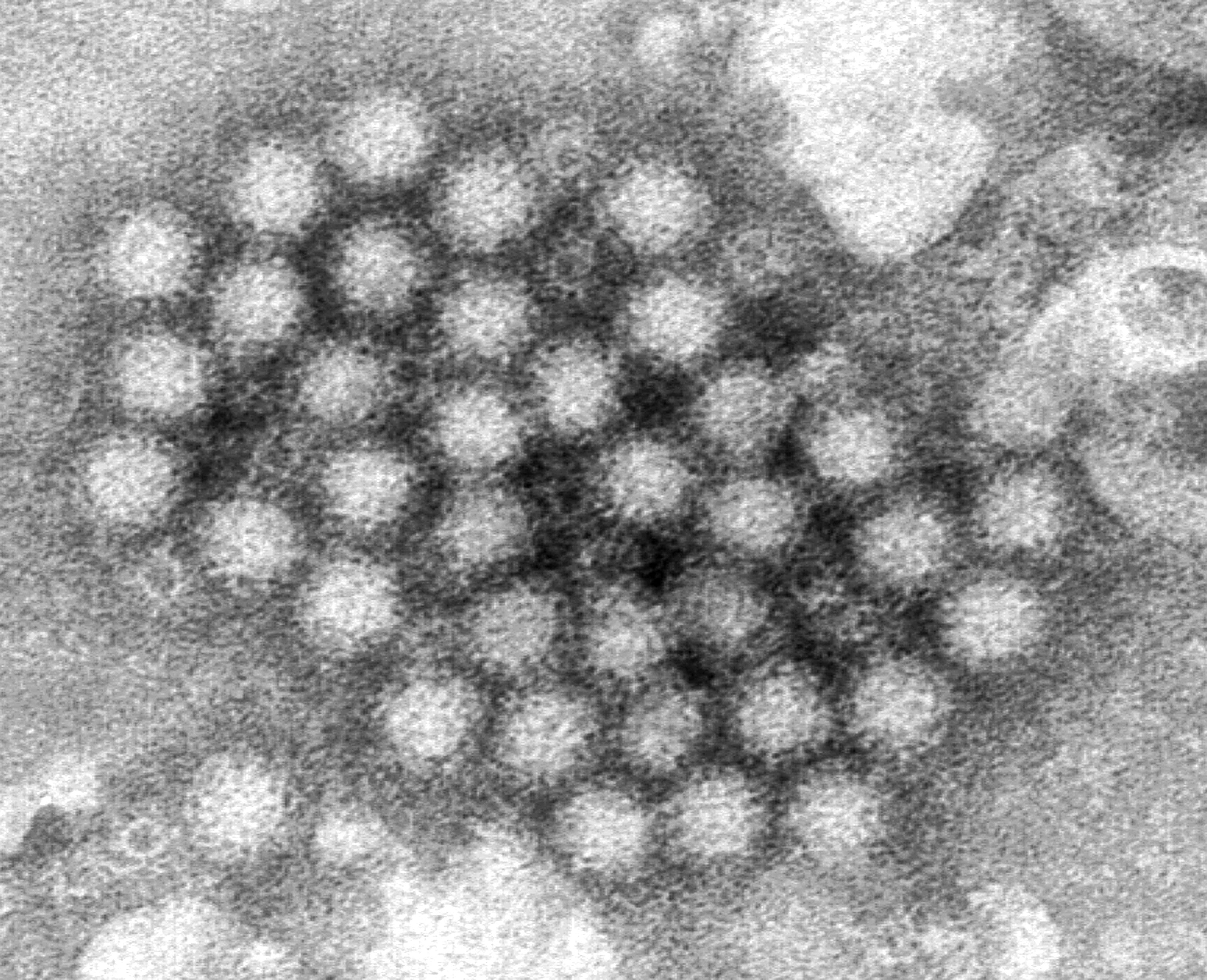 Cases of norovirus are surging in parts of the United States this winter