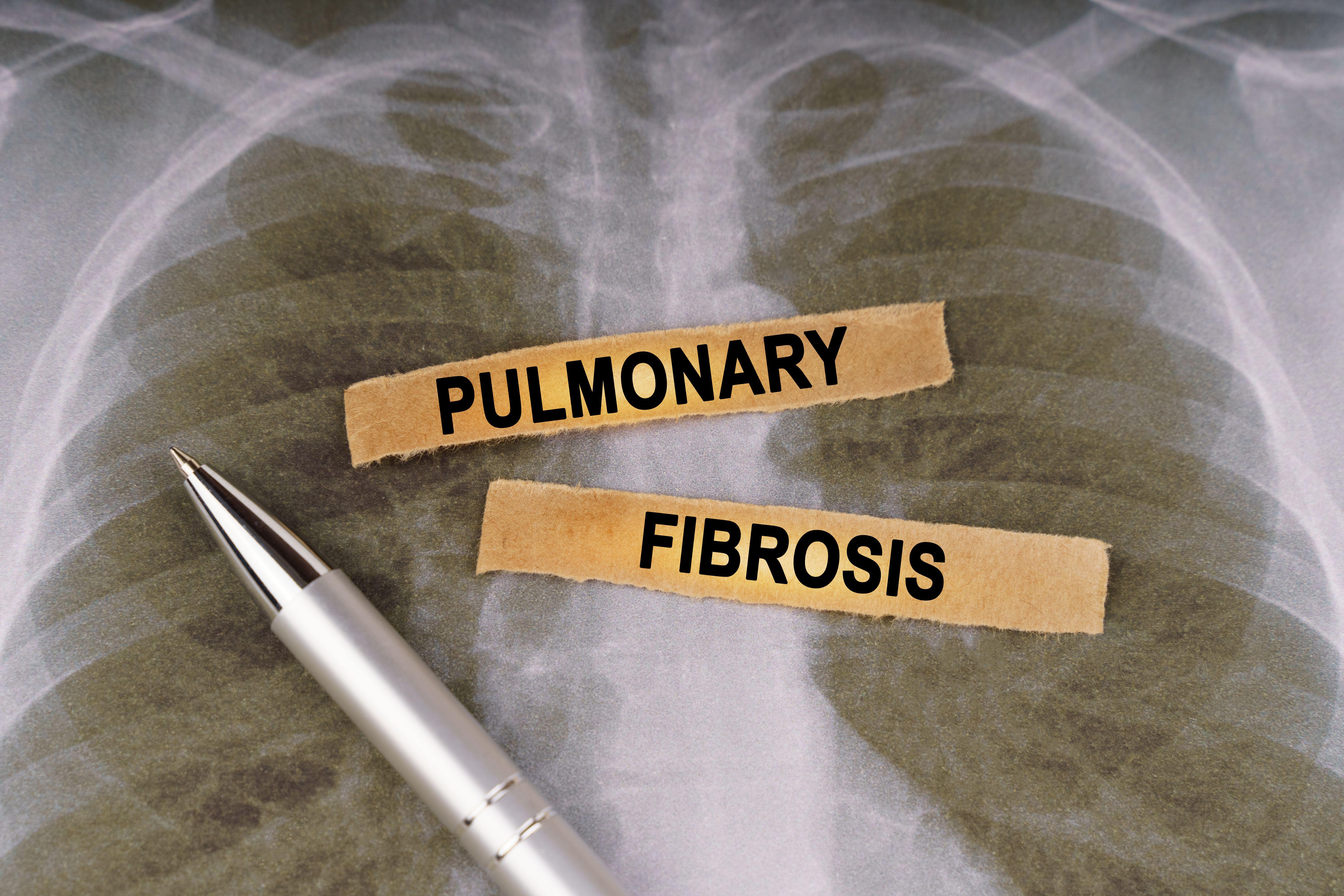 Any scarring that’s already in your lungs cannot be reversed