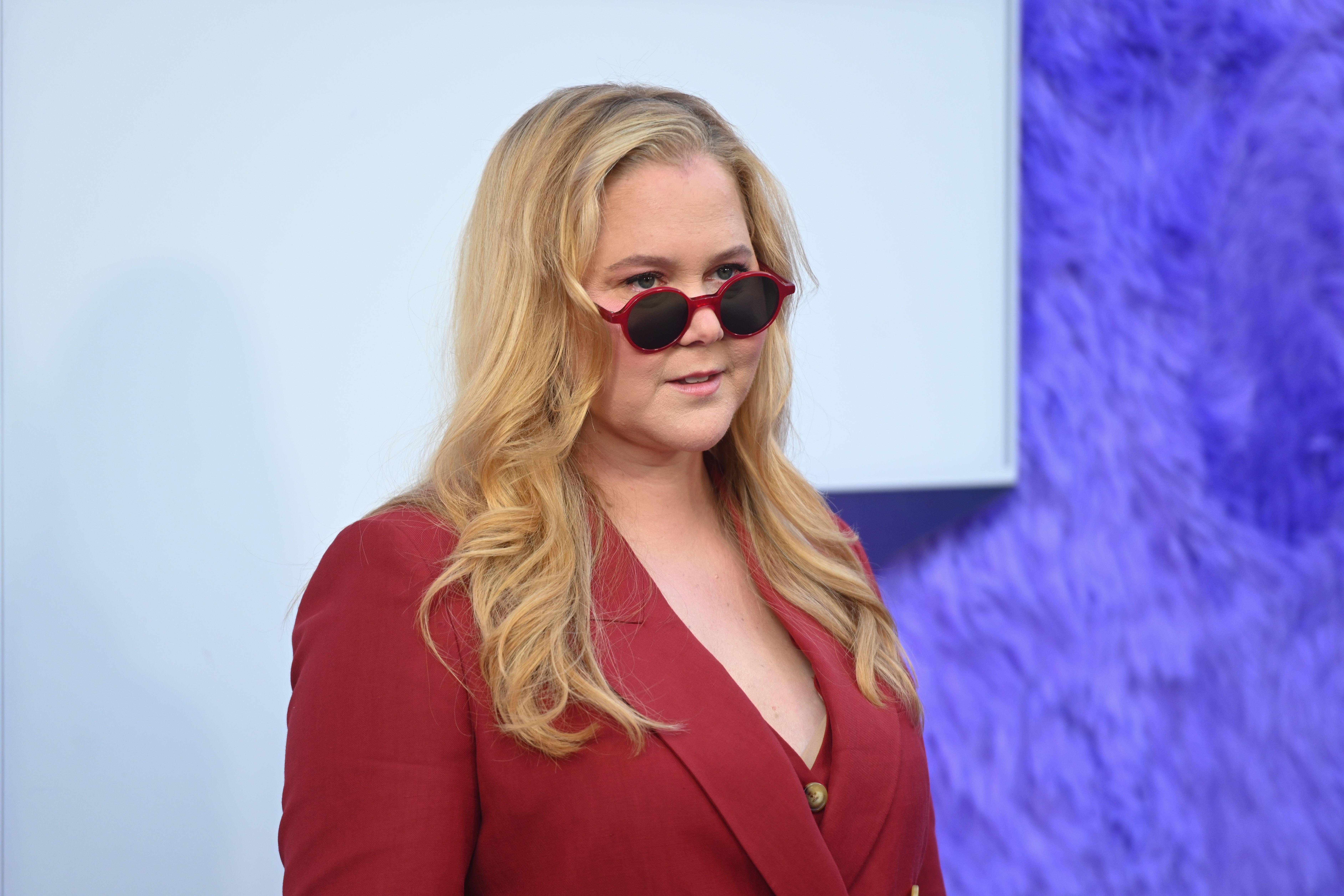 Amy Schumer opened up about Cushing’s Syndrome on the Call Her Daddy podcast
