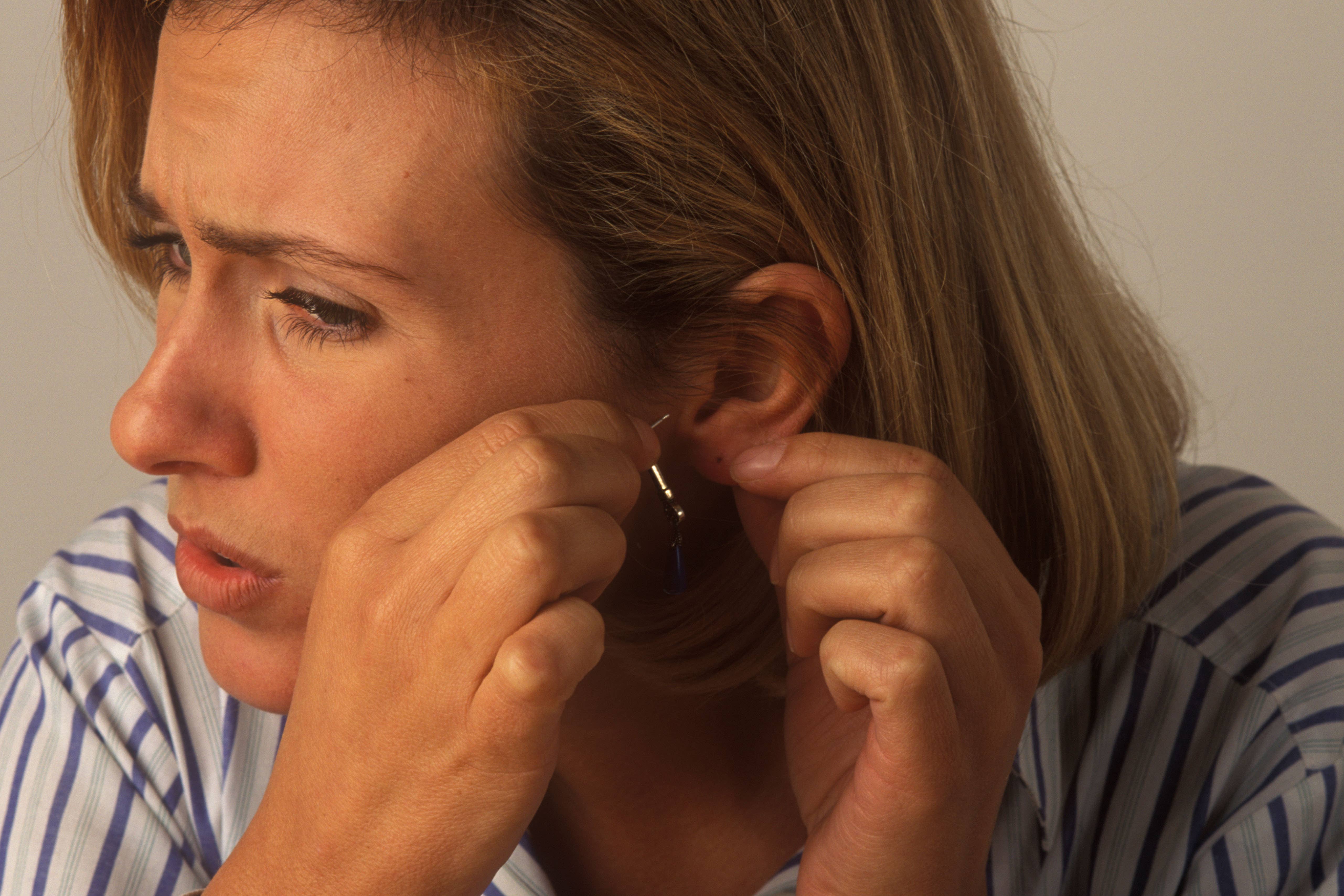 Here’s how to avoid allergic reactions from jewellery (Alamy/PA)