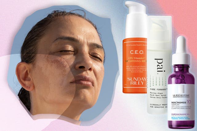 <p>Common types of pigmentation are melasma, post-acne marks and solar lentigines from UV exposure </p>