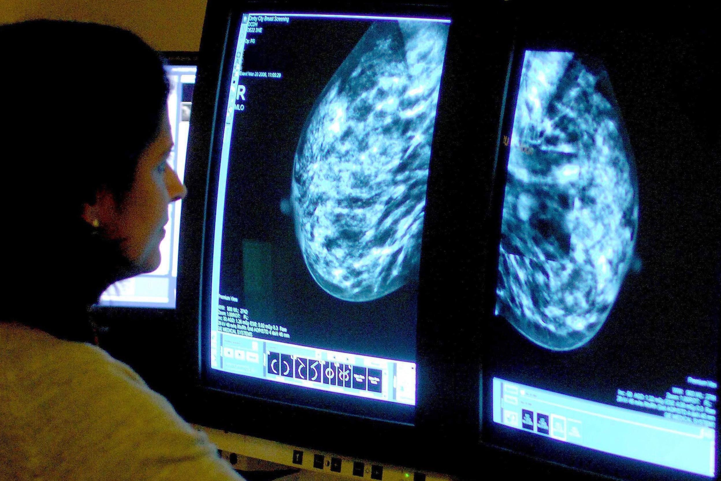 A consultant analysing a mammogram (PA)