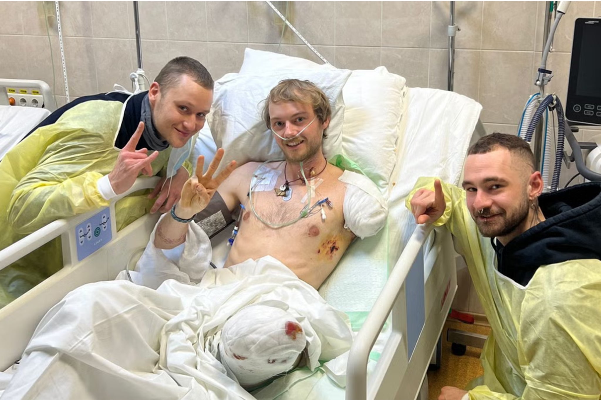 British volunteer Eddy Scott lost an arm and a leg in Ukraine - and now wants to help others in similar situations