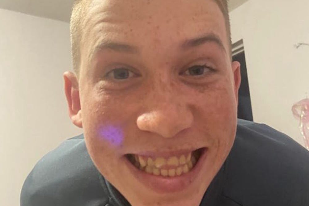 Roman Casselden, 16, who was riding an e-scooter with his sister Darcie, nine, when they were hit by a car (Essex Police/PA)