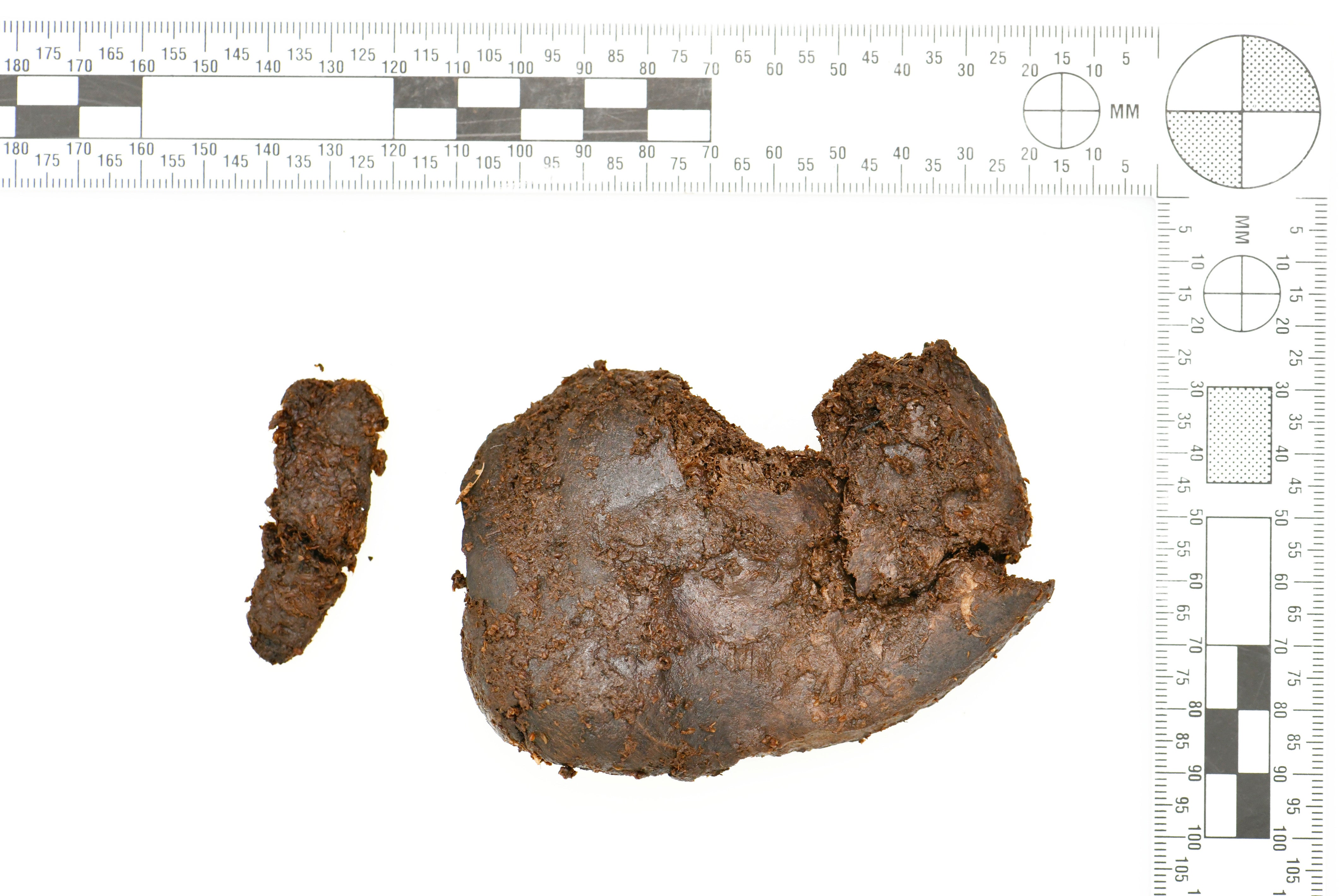 The kidney that was found with bones in 2023 which are believed to belong to a young woman who lived around 2,000 years ago