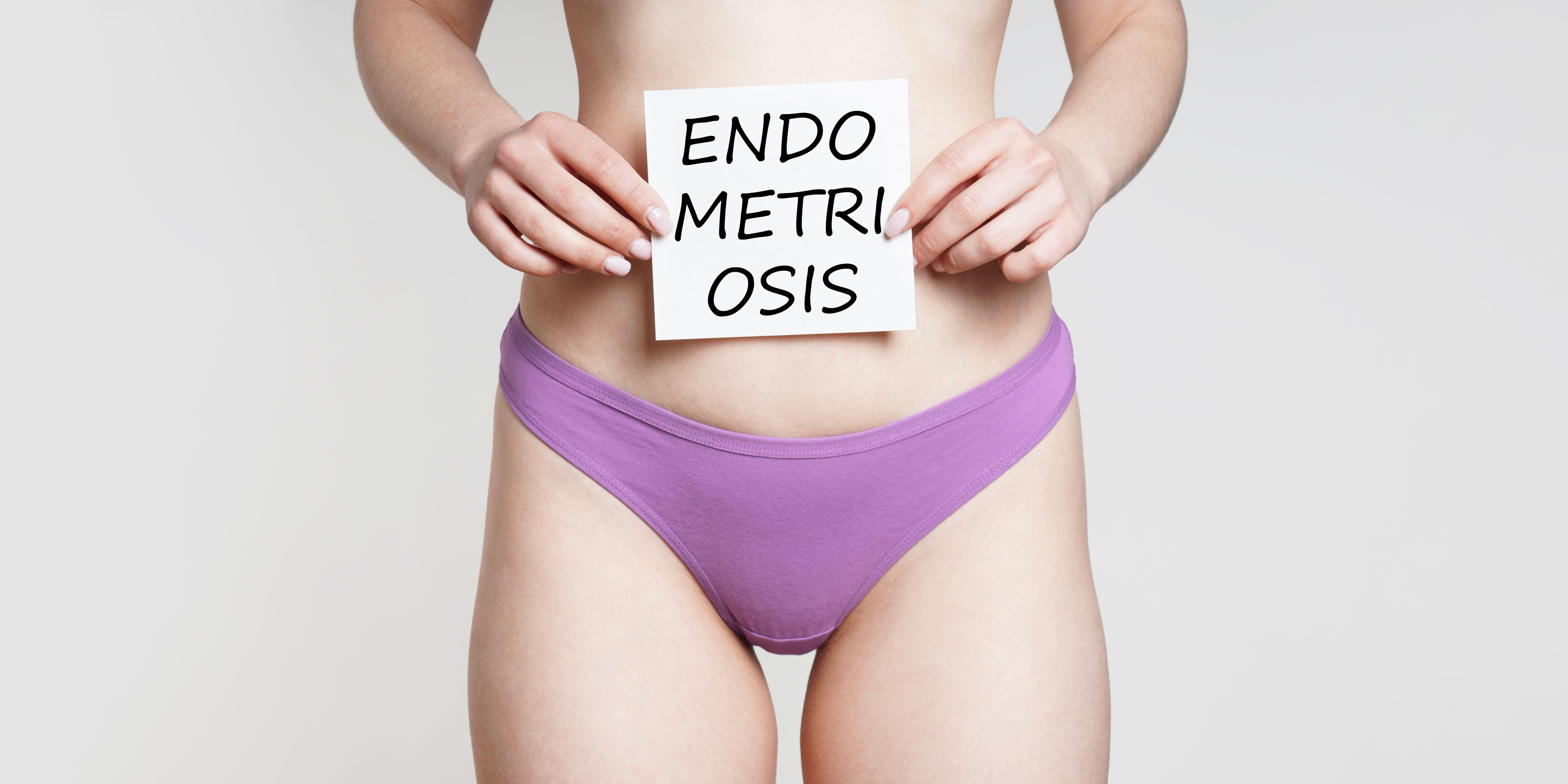 Endometriosis is when uterine endometrial-like tissue grows outside the uterus