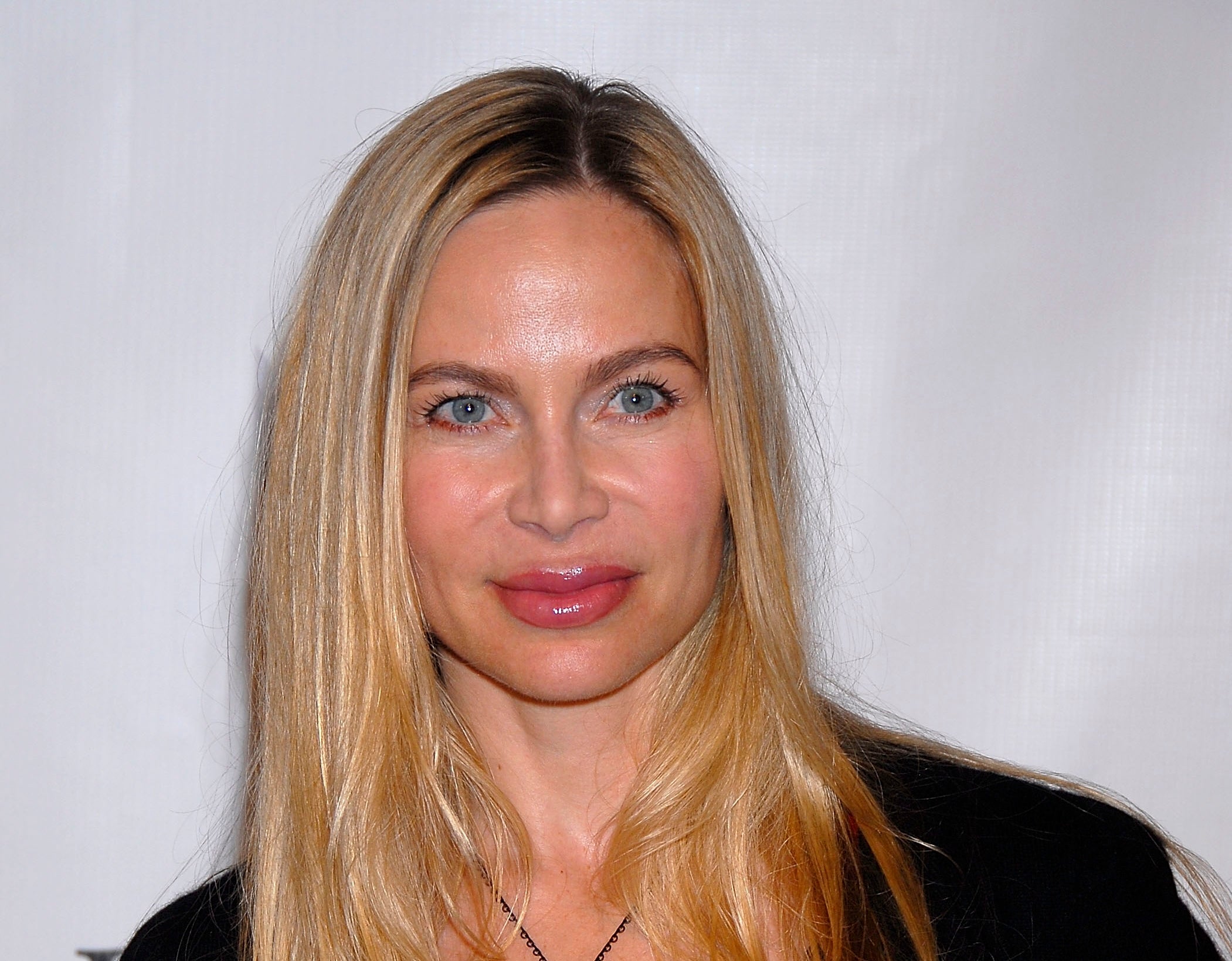 Christina Fulton claimed the alleged assault left her with ‘life-threatening injuries’