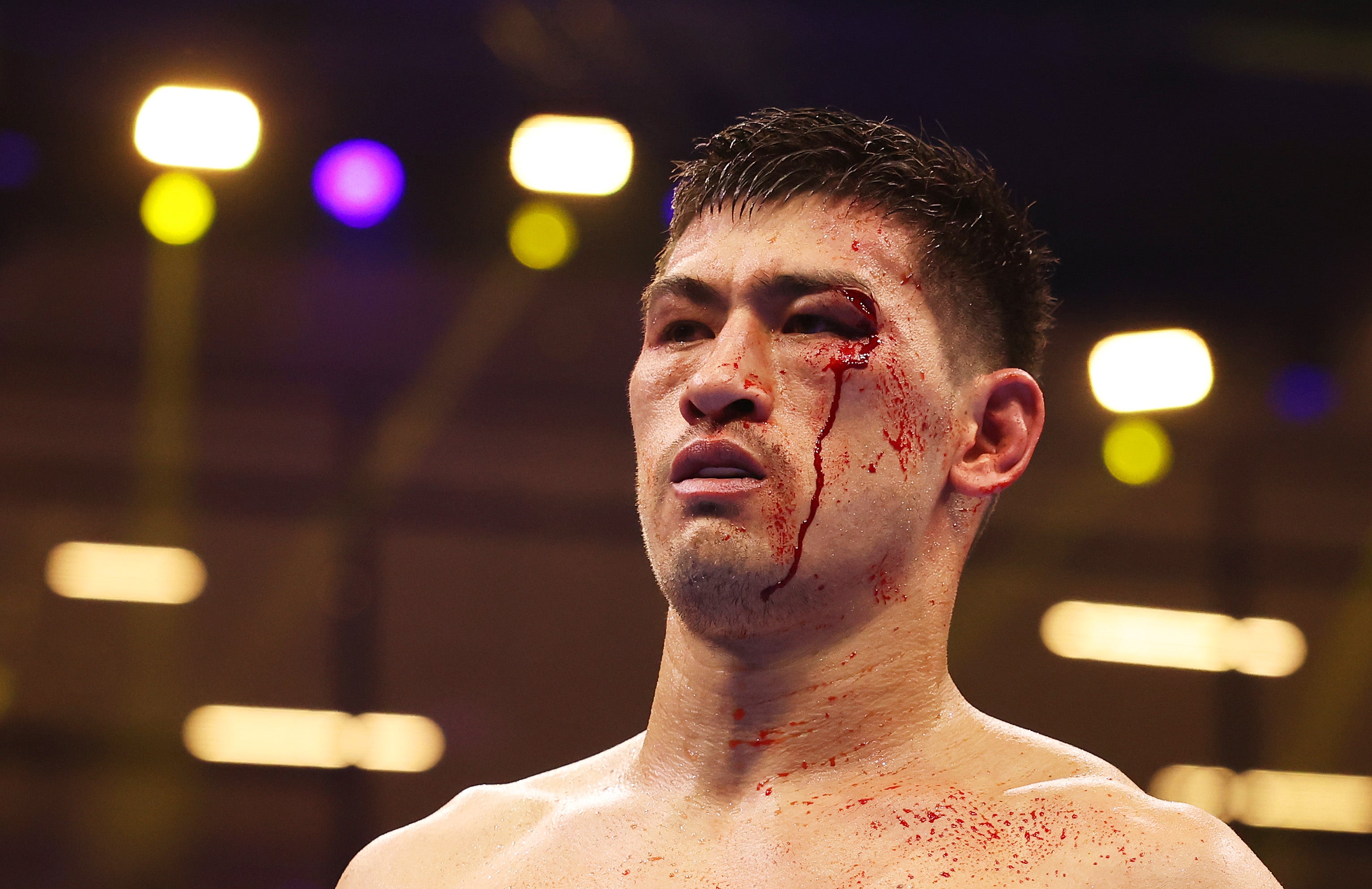 Bivol was cut badly late on, but he marked up Beterbiev’s face throughout the bout