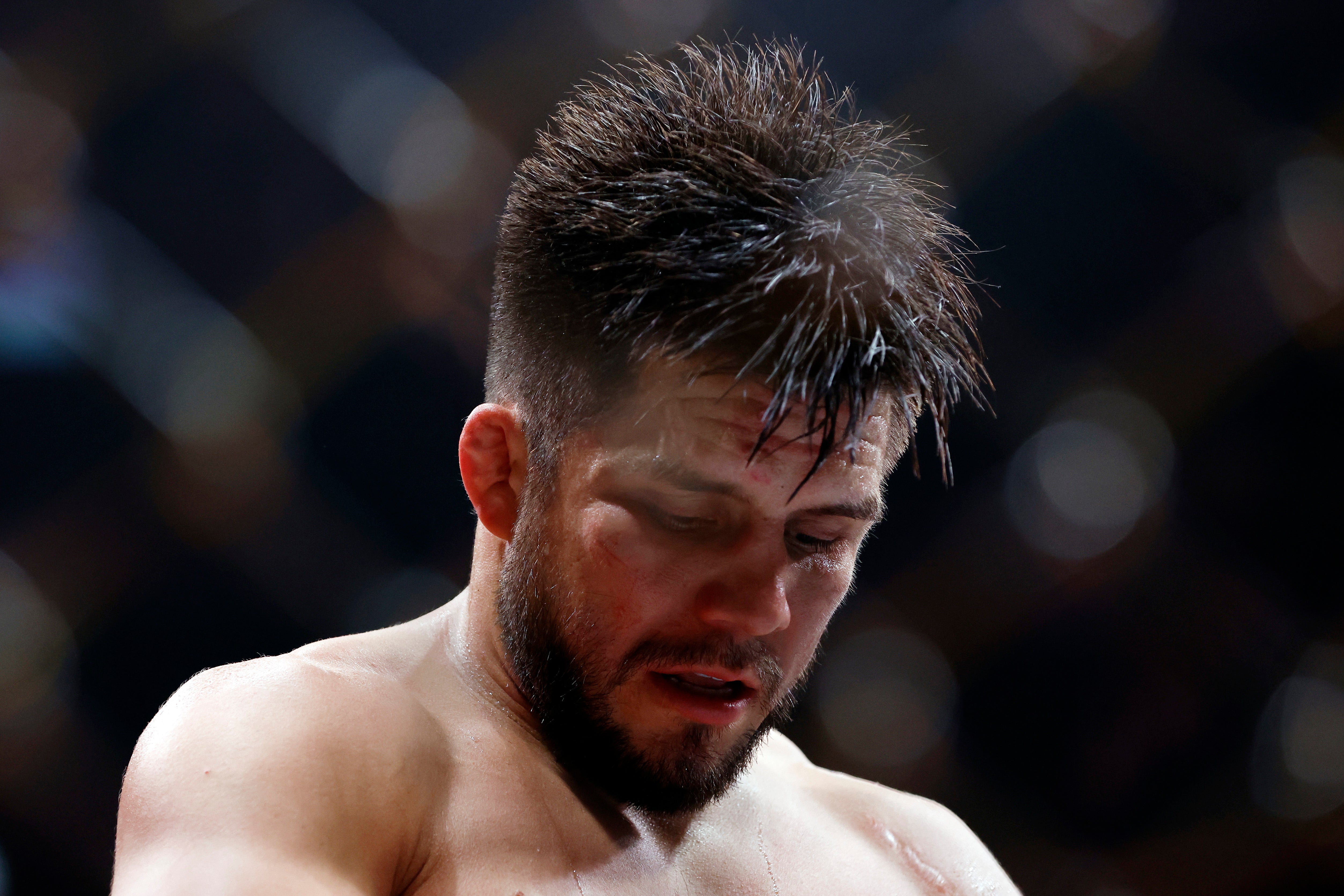 Henry Cejudo shows damage to eye after fans taunt him over end of Song Yadong fight