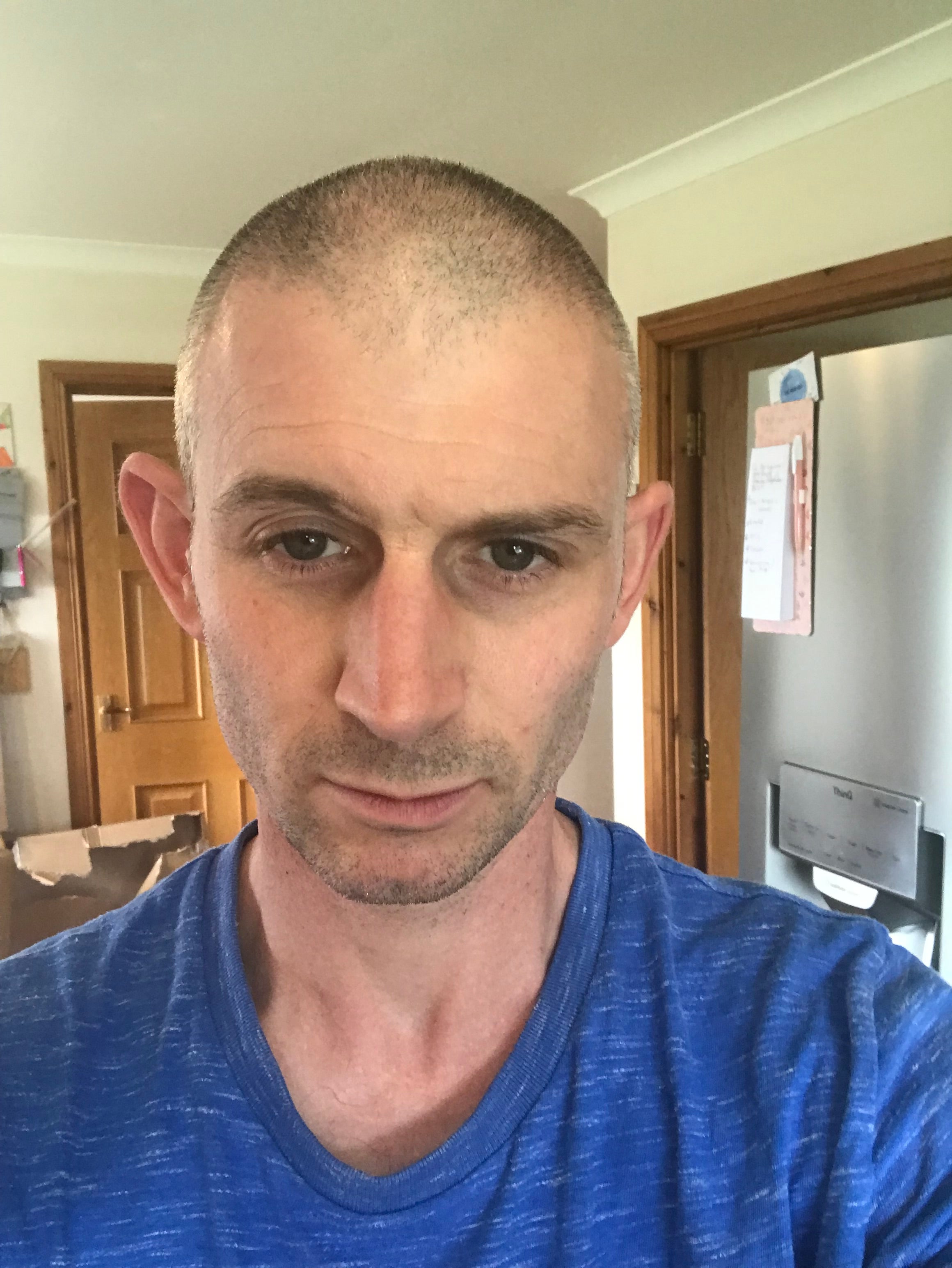 James is fundraising to cover the costs of haematopoietic stem cell transplantation