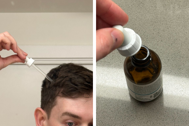 I have used this serum on my scalp for years