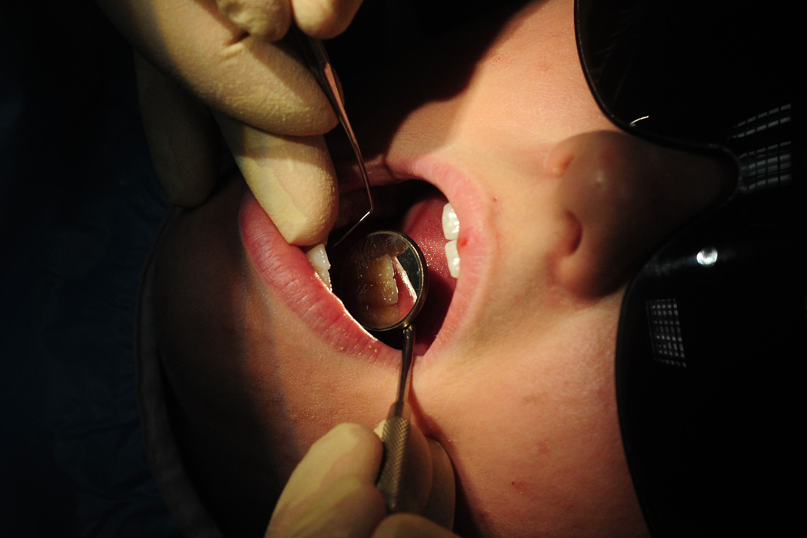 The government has promised an additional 700,000 urgent dental appointments (PA)