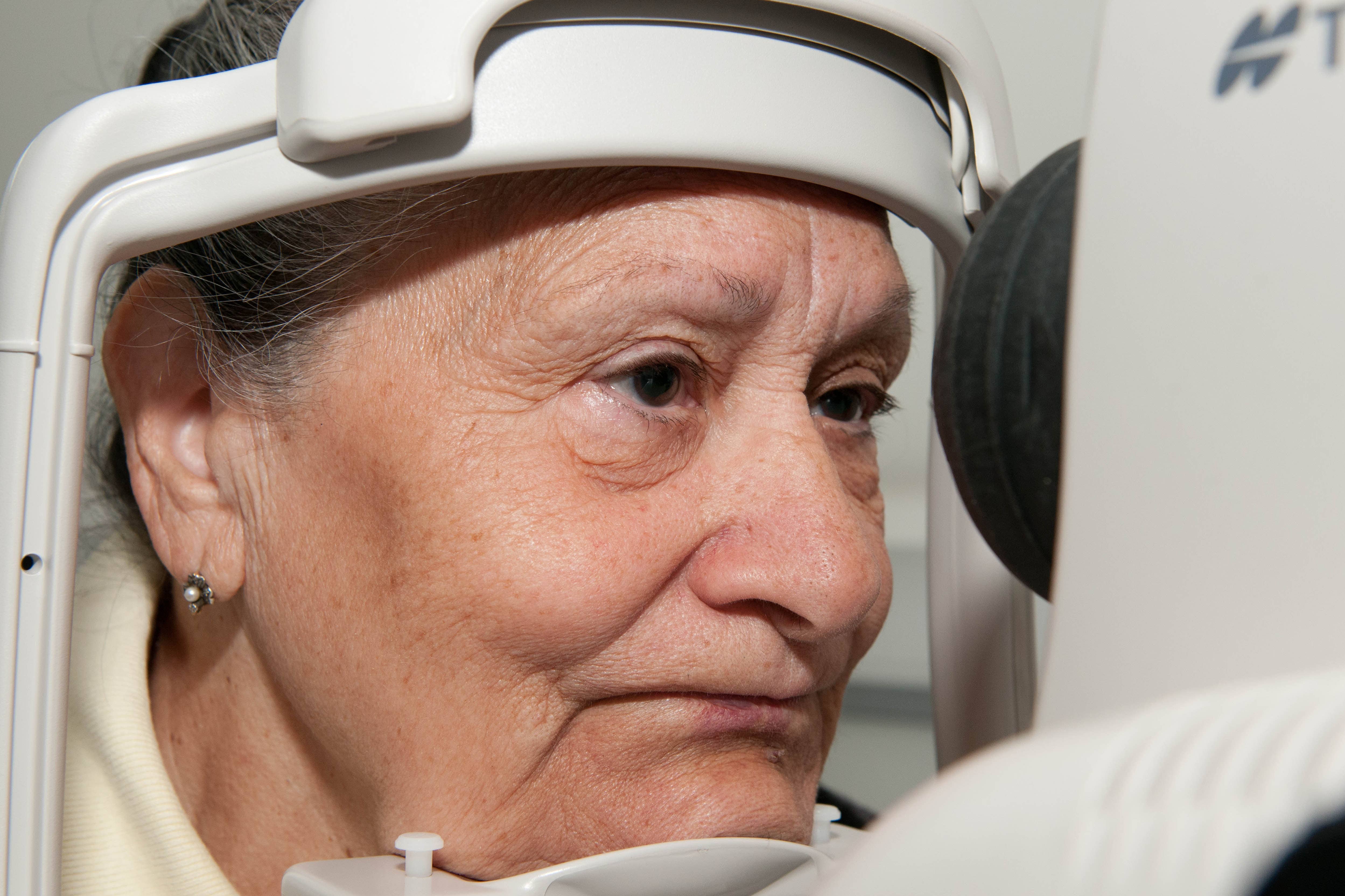 Research suggests diabetic eye screening may also be able to be used to predict kidney disease (Alamy/PA)