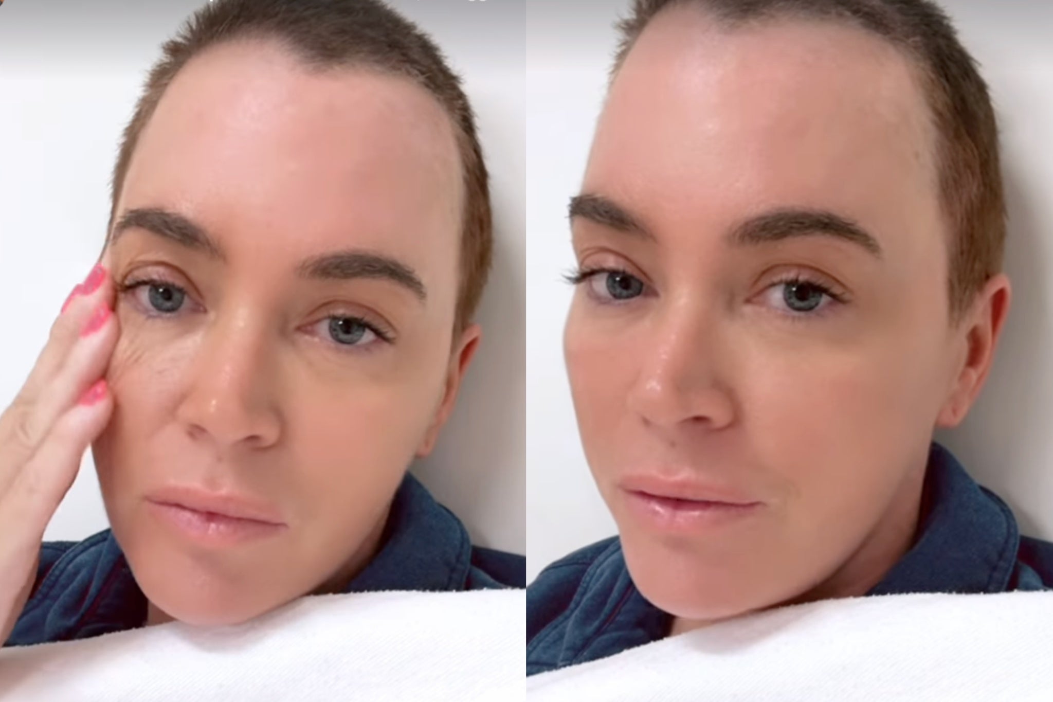 ‘I have multiple tumors in my brain that weren’t able to be removed via surgery. I also have 2 tumors in my lung,’ Mellencamp revealed