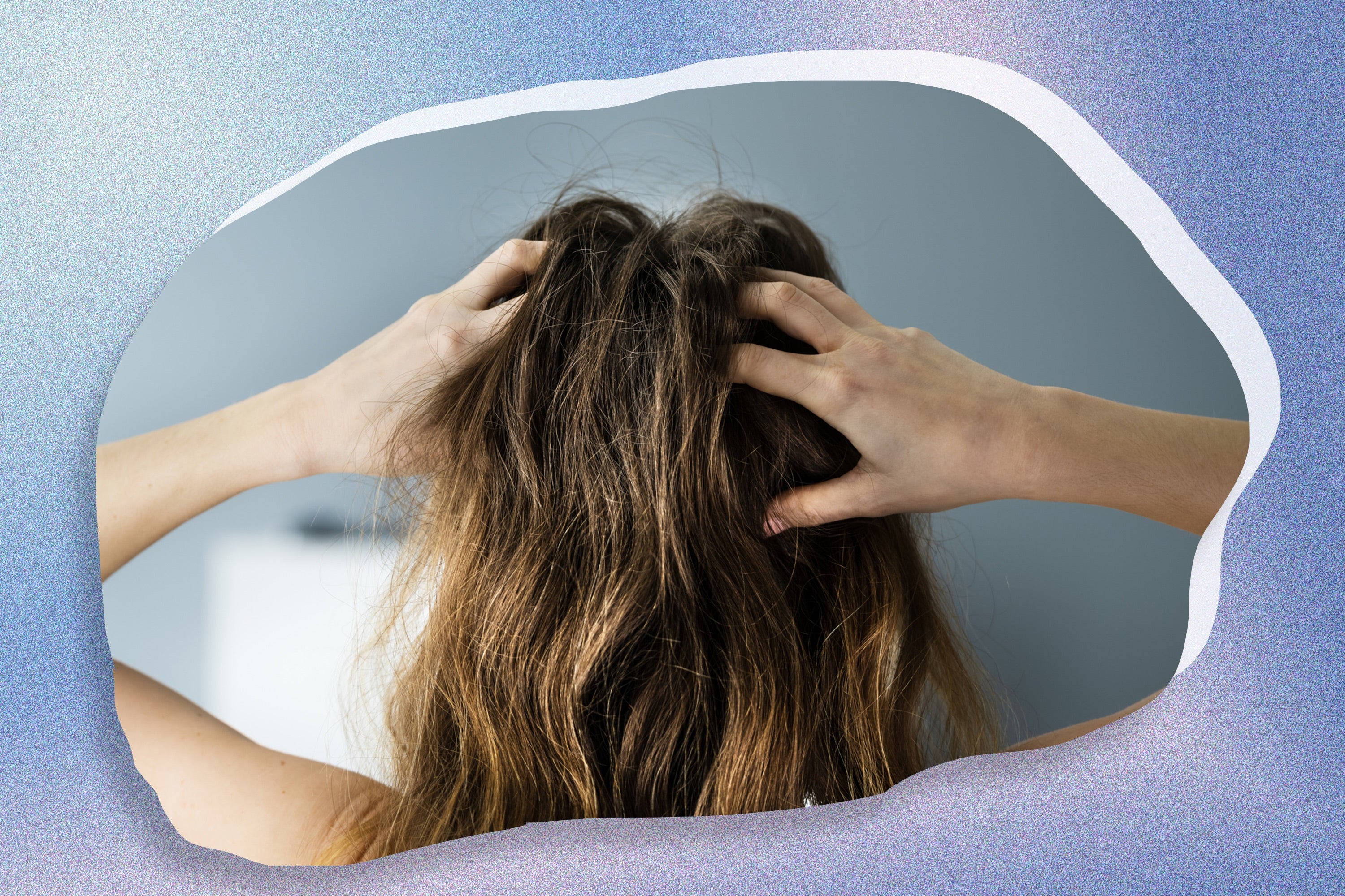 An expert says these are the itchy scalp treatments you need to try