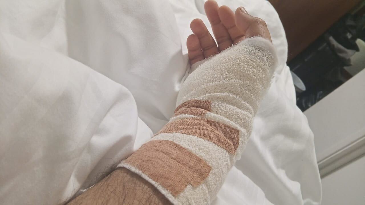 Mr Malikzada cannot use his right hand after the incident