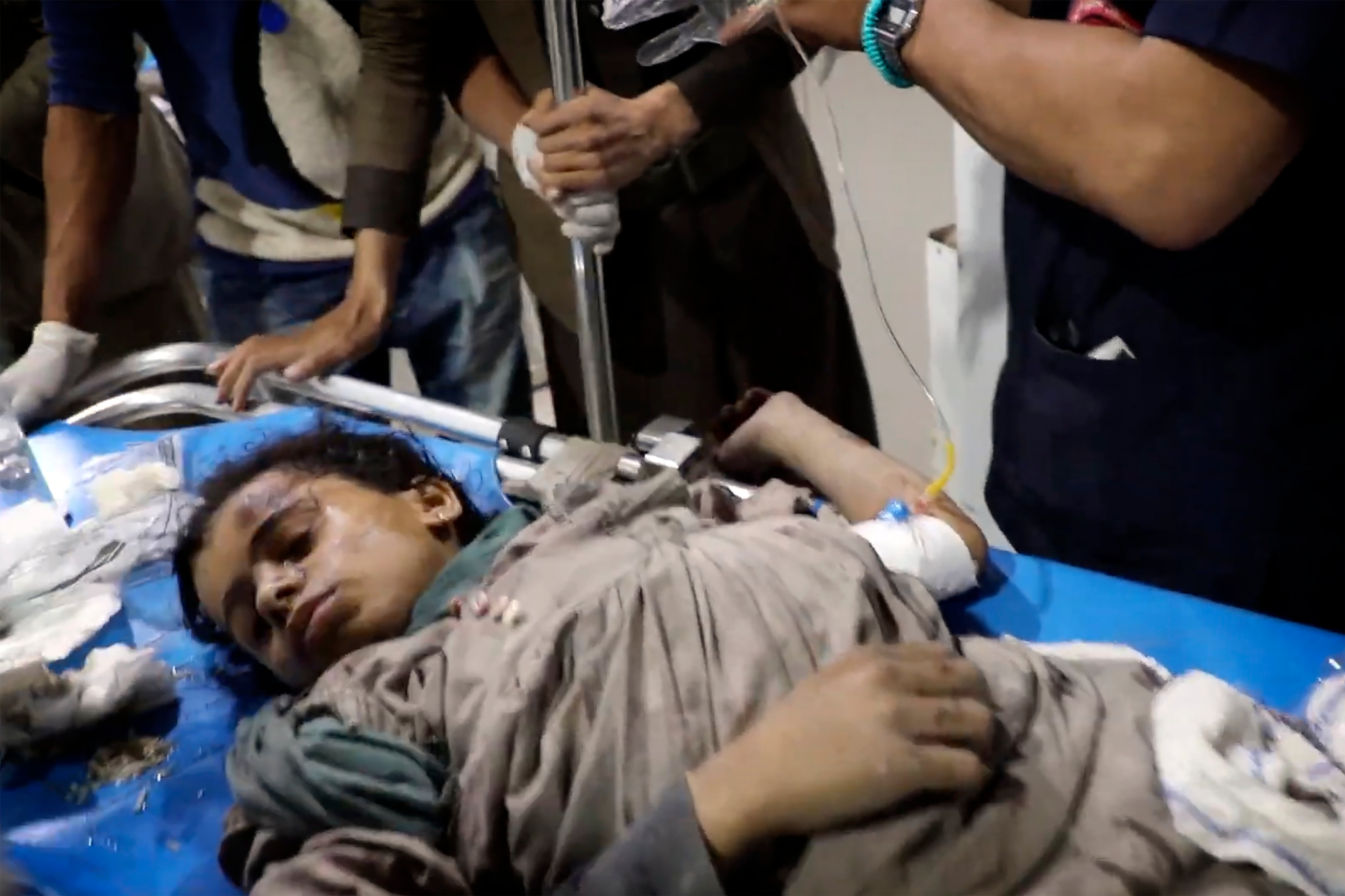 In this photo taken from video released by Ansar Allah Media Office via Al Masirah TV channel shows a wounded child being taken for treatment at a hospital in Saada, Yemen, Saturday, March 15, 2025 following airstrikes over multiple targets in the country.