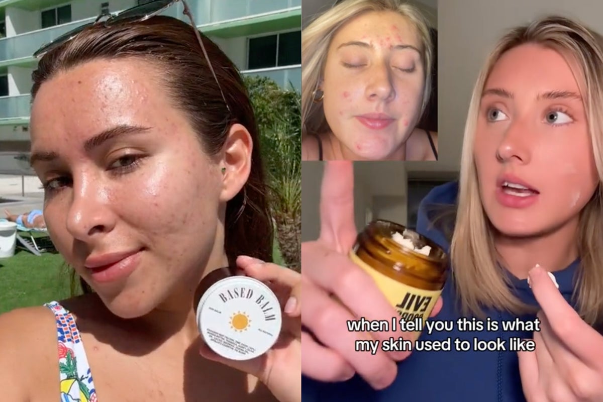 Beef tallow is TikTok’s next major skincare trend — but scientists can’t figure out why