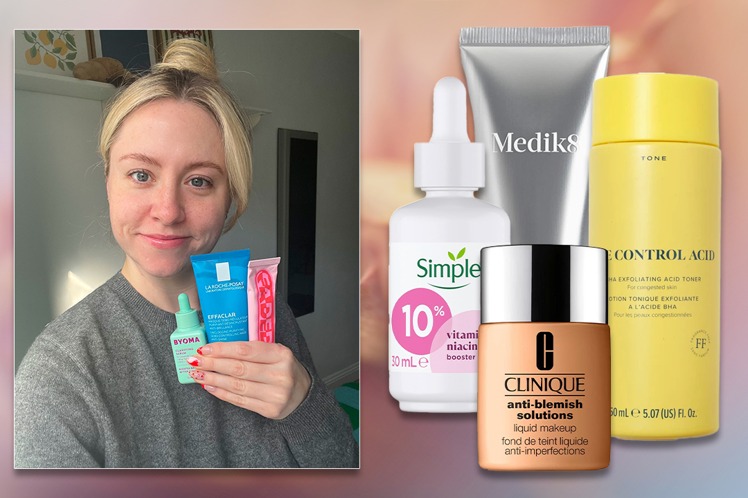 8 best blackhead treatments for achieving smoother skin