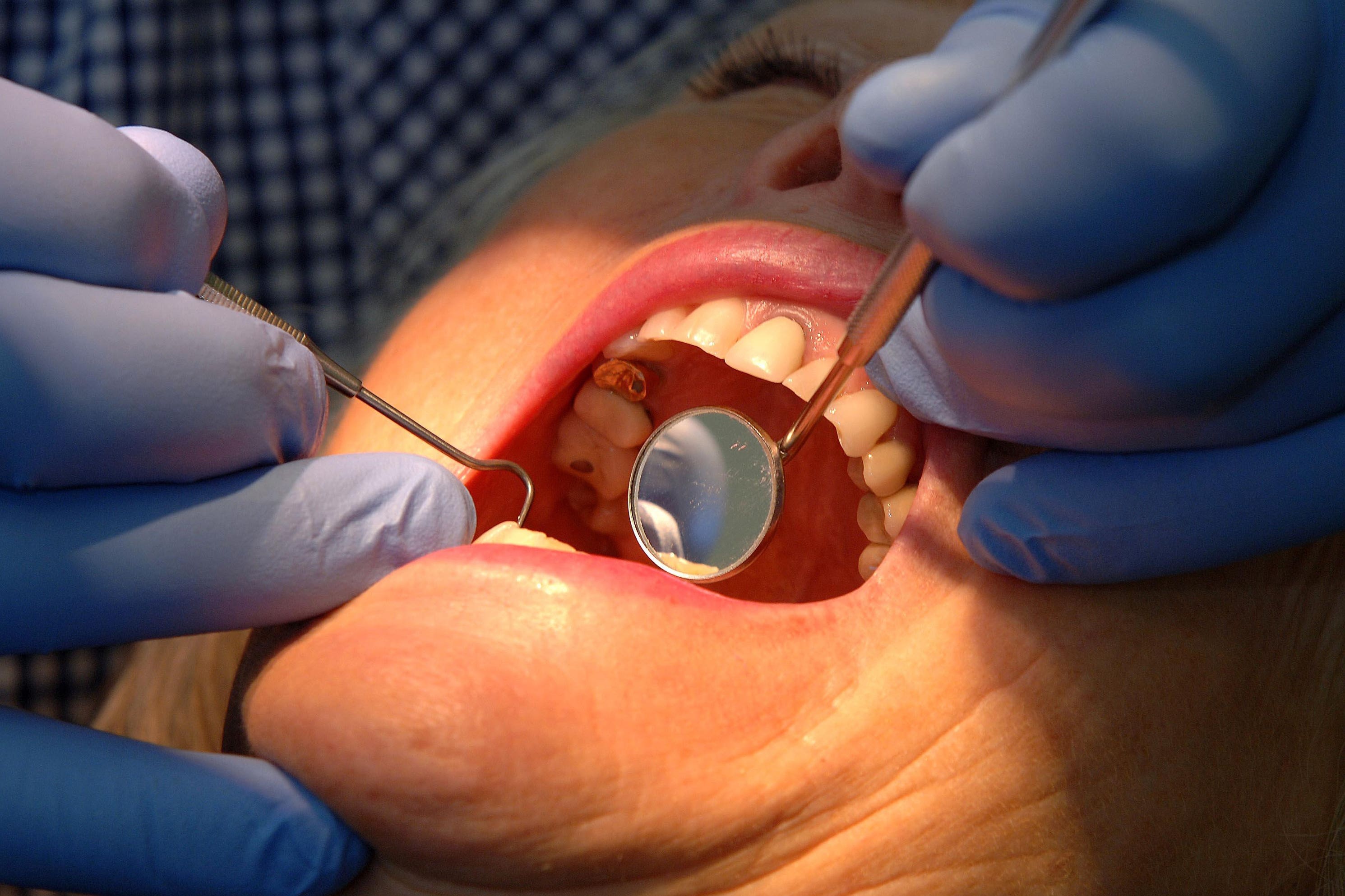 A dentist checks a patient’s teeth