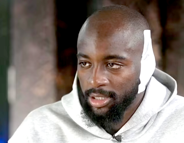 <p>Jean-Philippe Mateta was seen with a bandage during an inteview with Sky Sports</p>