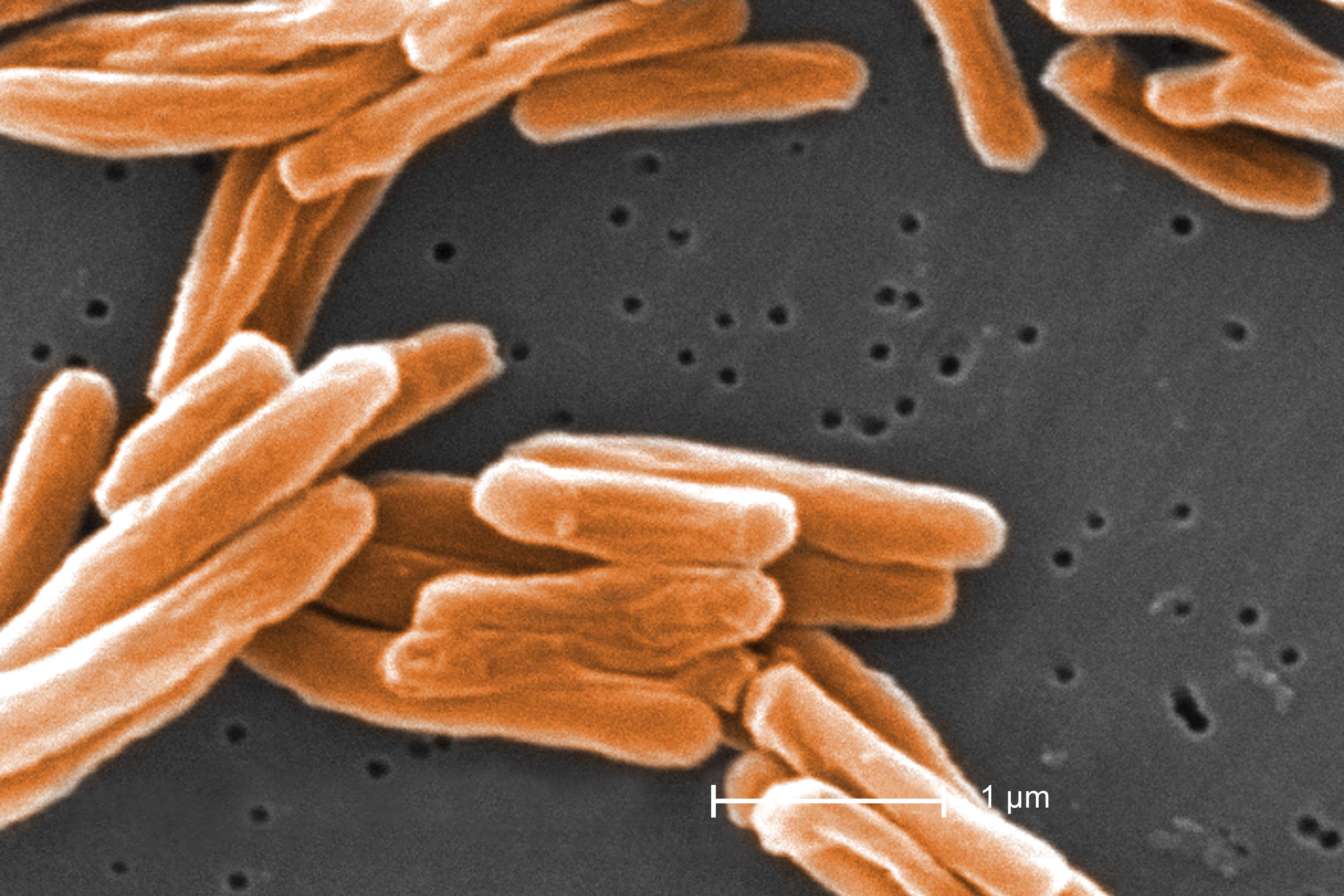 Scanning electron micrograph of tuberculosis bacteria (Alamy/PA)