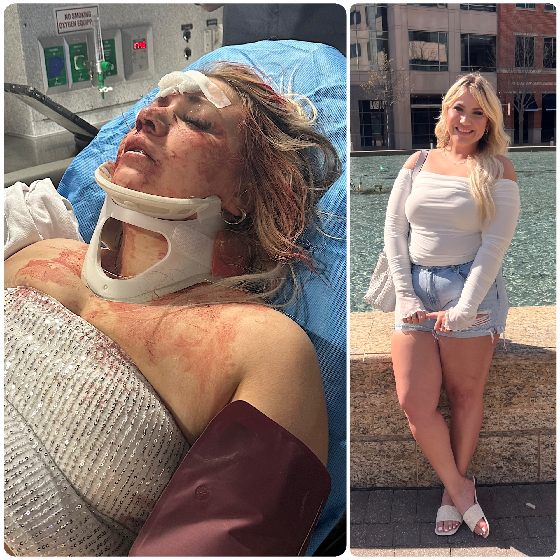 Canada Rinaldi, 27, is facing mounting medical costs after being attacked while celebrating her bachelorette
