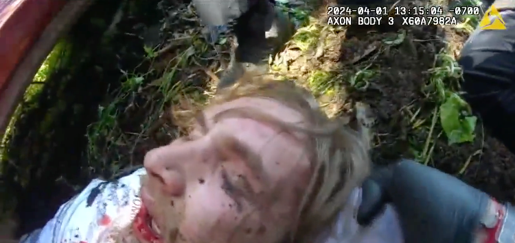 Lawsuit alleges police used harsh force on Bruce despite having warning he’d likely just had a seizure