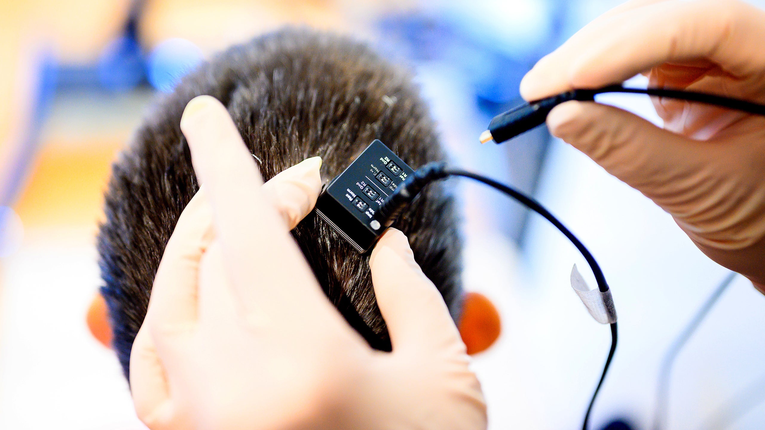 Researchers connect Ann's brain implant to voice synthesiser