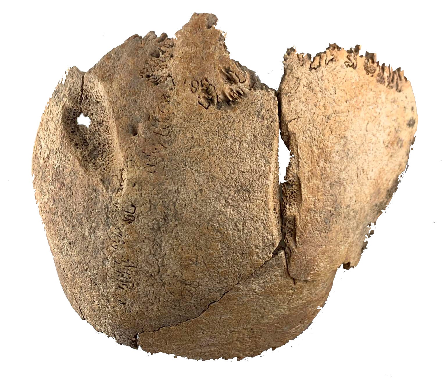 A skull with a sharp trauma fond at an excavation of a Roman mass grave from the end of the 1st century AD in the Simmering district of Vienna, Austria photographed on Thursday, March 27, 2025. (S. Strang/Novetus via AP)