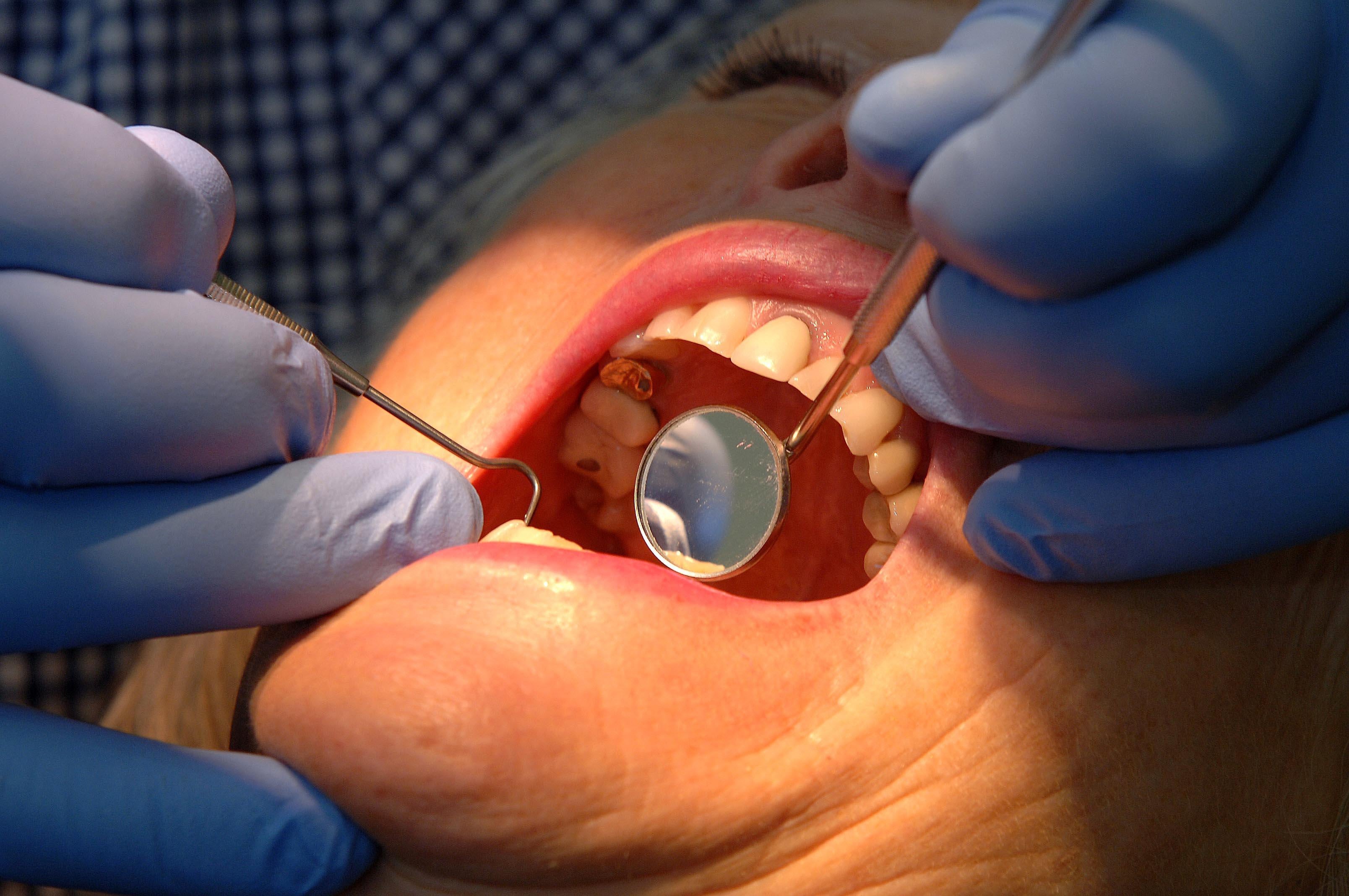 The Dental Recovery Plan has ‘comprehensively failed’ according to the Public Accounts Committee (PAC)