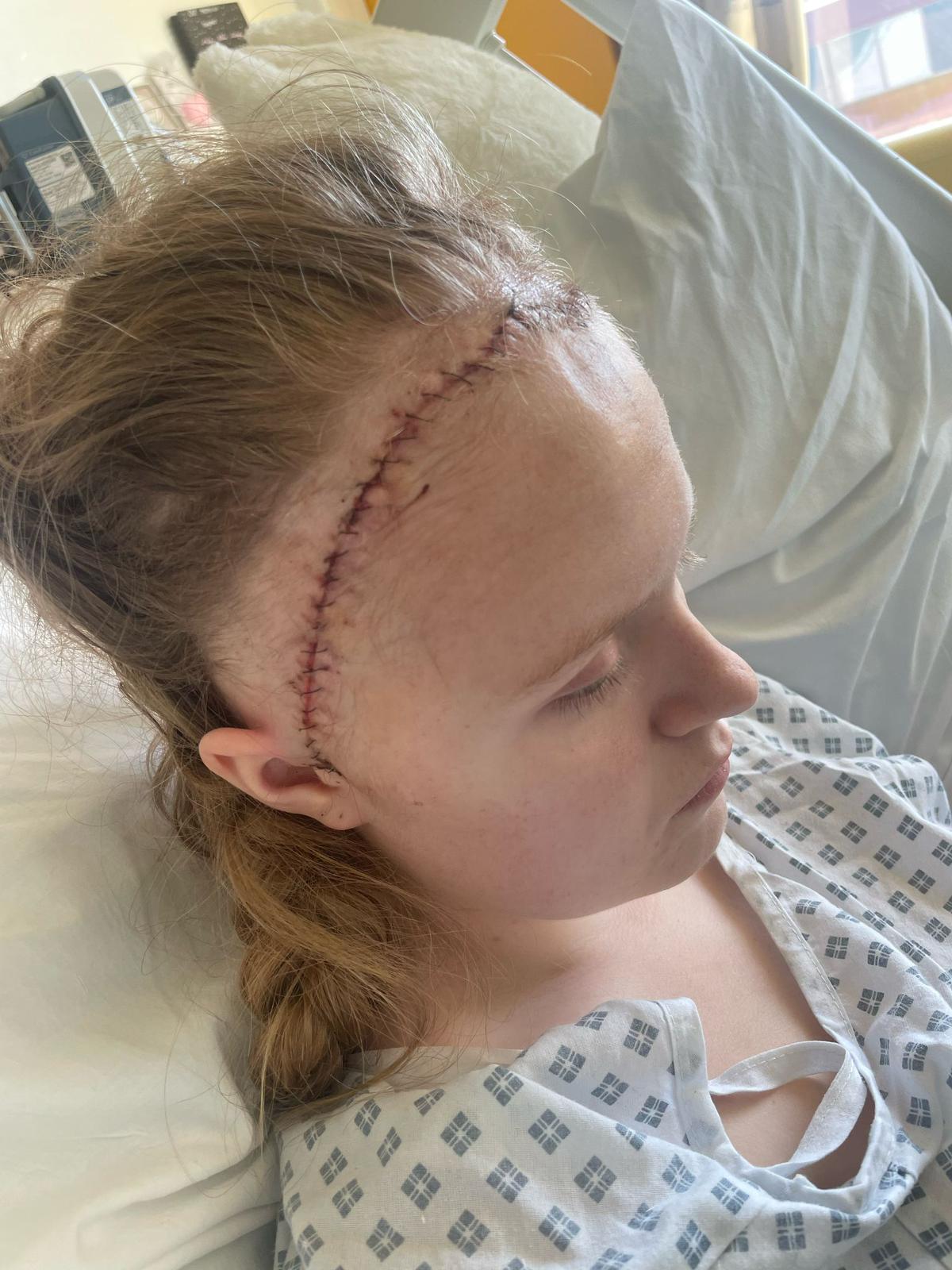 Ellie Morris-Davies after surgery at Alder Hey Children's Hospital in Liverpool