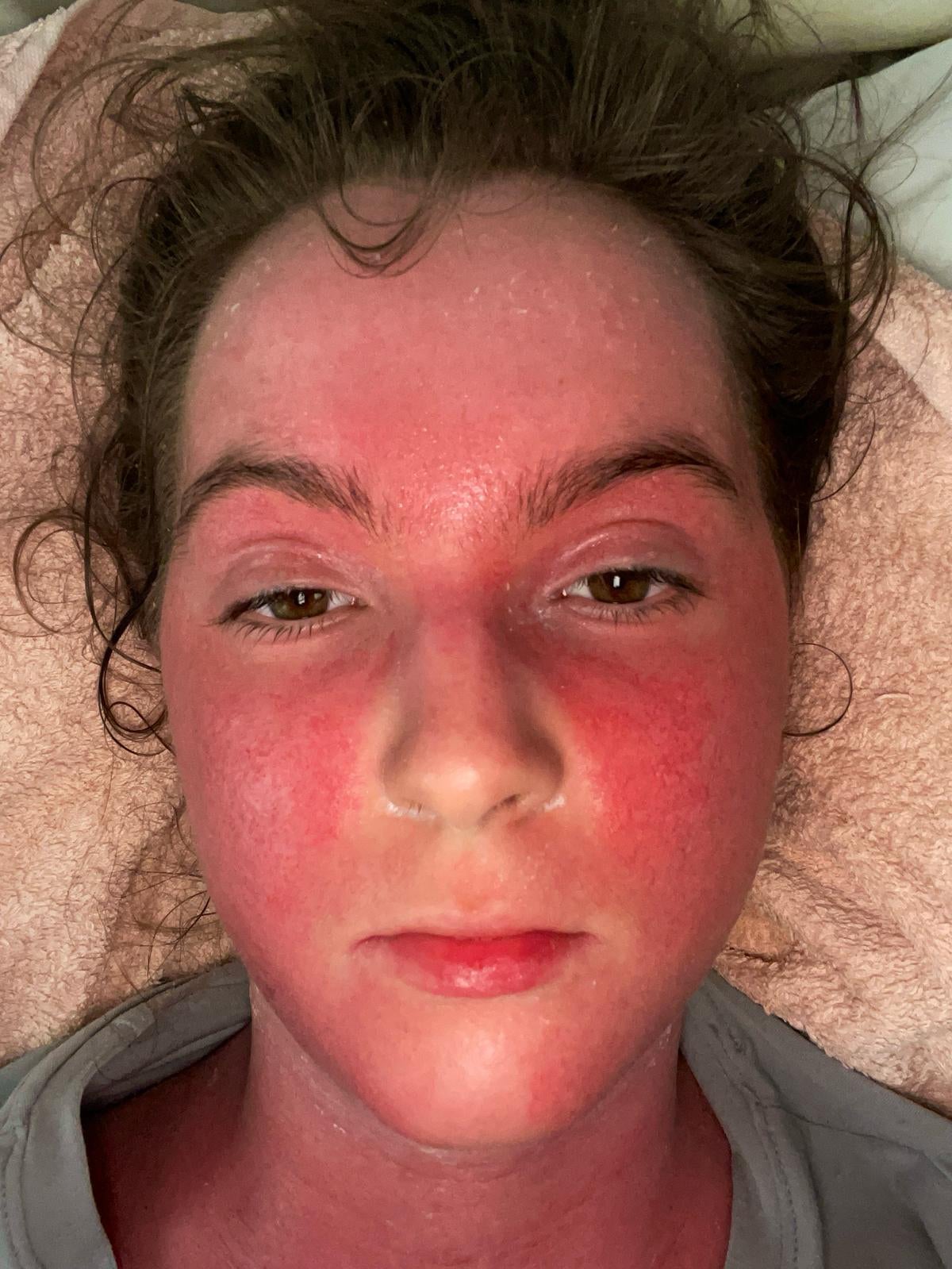 Bethany said her symptoms have made her feel 'lonely' and 'isolated'