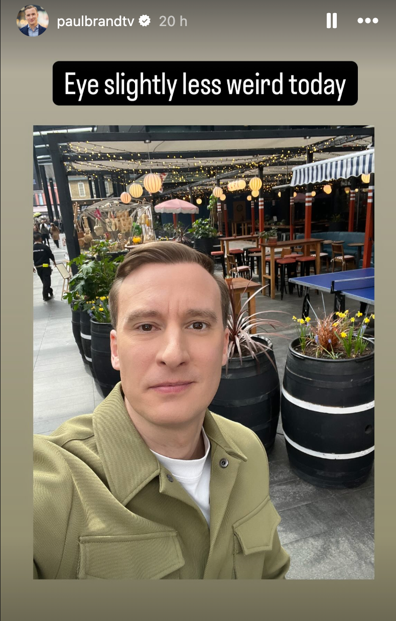 Newsreader said his eye was ‘slightly less weird’ after his appearance sparked concern