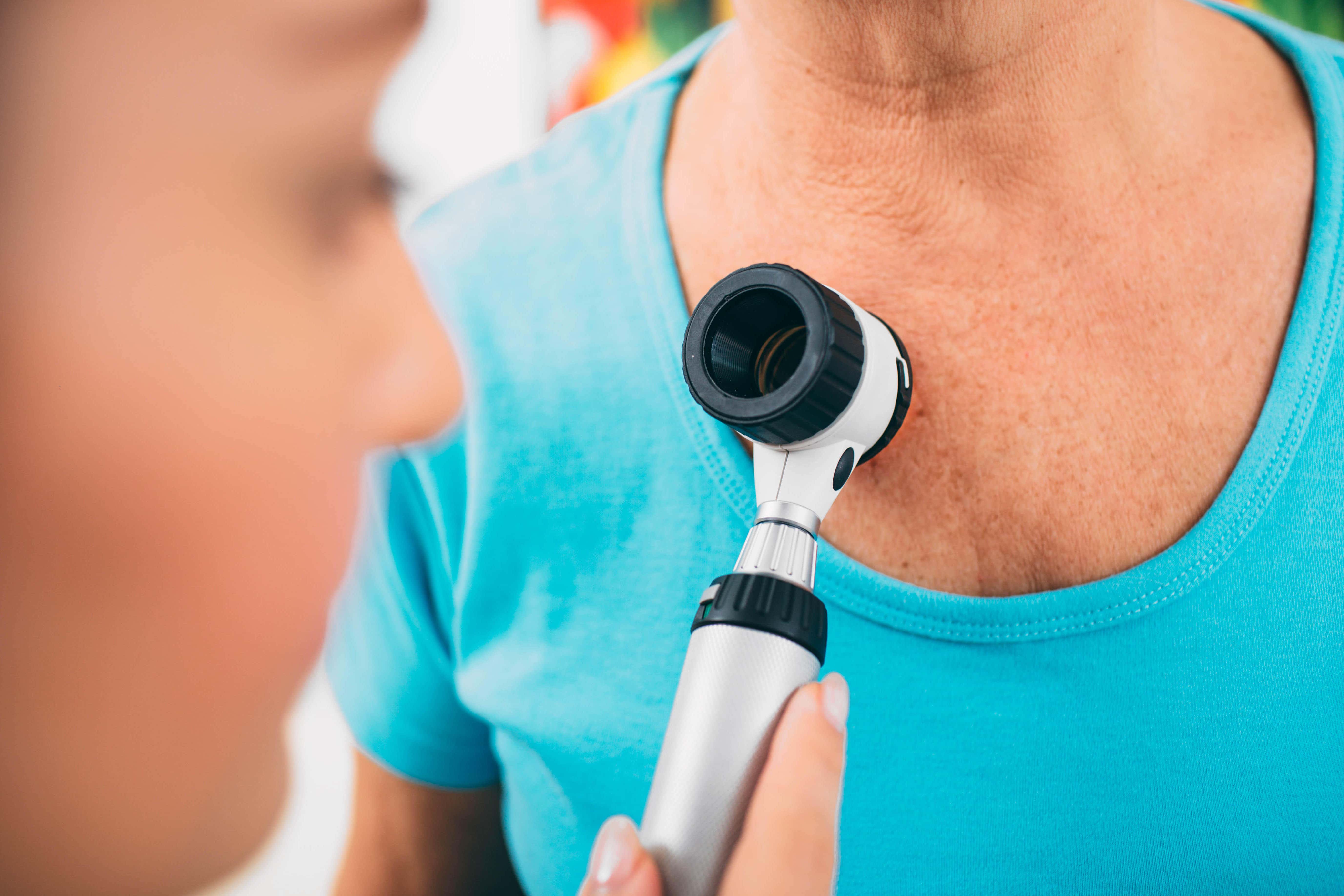 The new melanoma vaccine helps the immune system recognise cancer cells and therefore better respond to existing immunotherapy treatment (Alamy/PA)